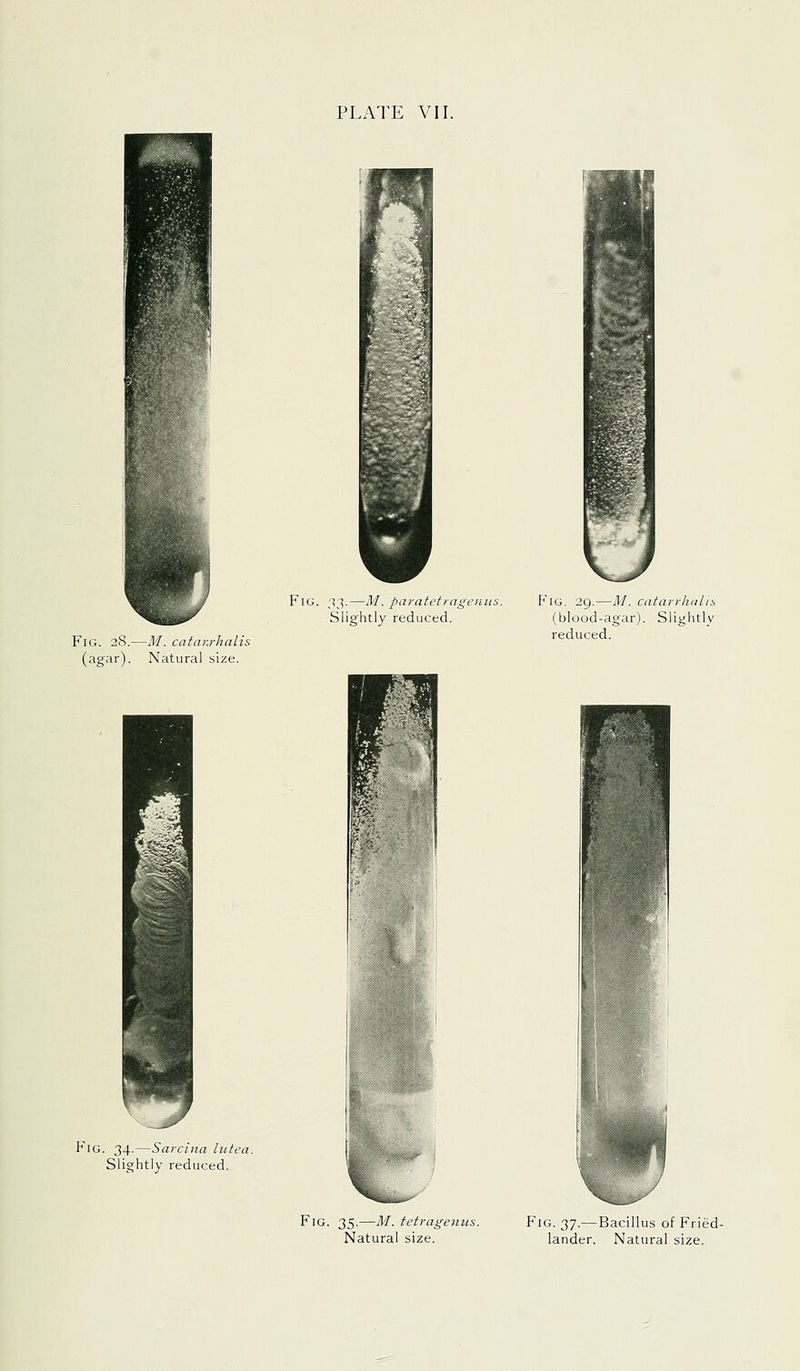 E,j>^, i^ Fig. .!3.—M. paratetragenus. Slightly reduced. Fig. 28. (agar). -M. catar.rhalis Natural size. F'iG. 29.—M. catarrhalis (blood-agar). Slightly reduced. Fig. 34.—Sarcina lutea. Slightly reduced. Fig. 35.—M. tetragenus. Natural size. Fig. 37.—Bacillus of Fried- lander. Natural size.