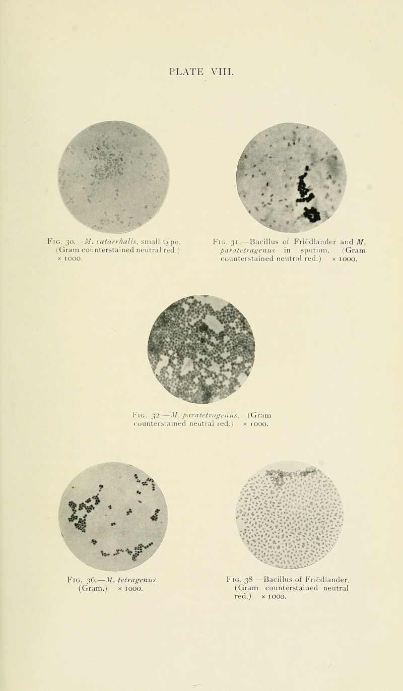 PLATE VIII. Fig. 30.—M. catarrhalis, small t_\'pe. (Gram counterstained neutral red.) X 1000. Fig. 31.—Bacillus of Friedlander and If. paratt'trai(enu^ in sputum. (Gram counterstained neutral red.) x looo. l'lG. 32.—yi. pnratetrngeiuis. (Gram counterstained neutral red.) x 1 000. «? '■^A^iK^i^:.:- Fig. 36.—y/. tetrageniLS. (Gram.) x 1000. Fig. 38 —Bacillus of Friedlander. (Gram counterstaiaed neutral red.) X 1000.