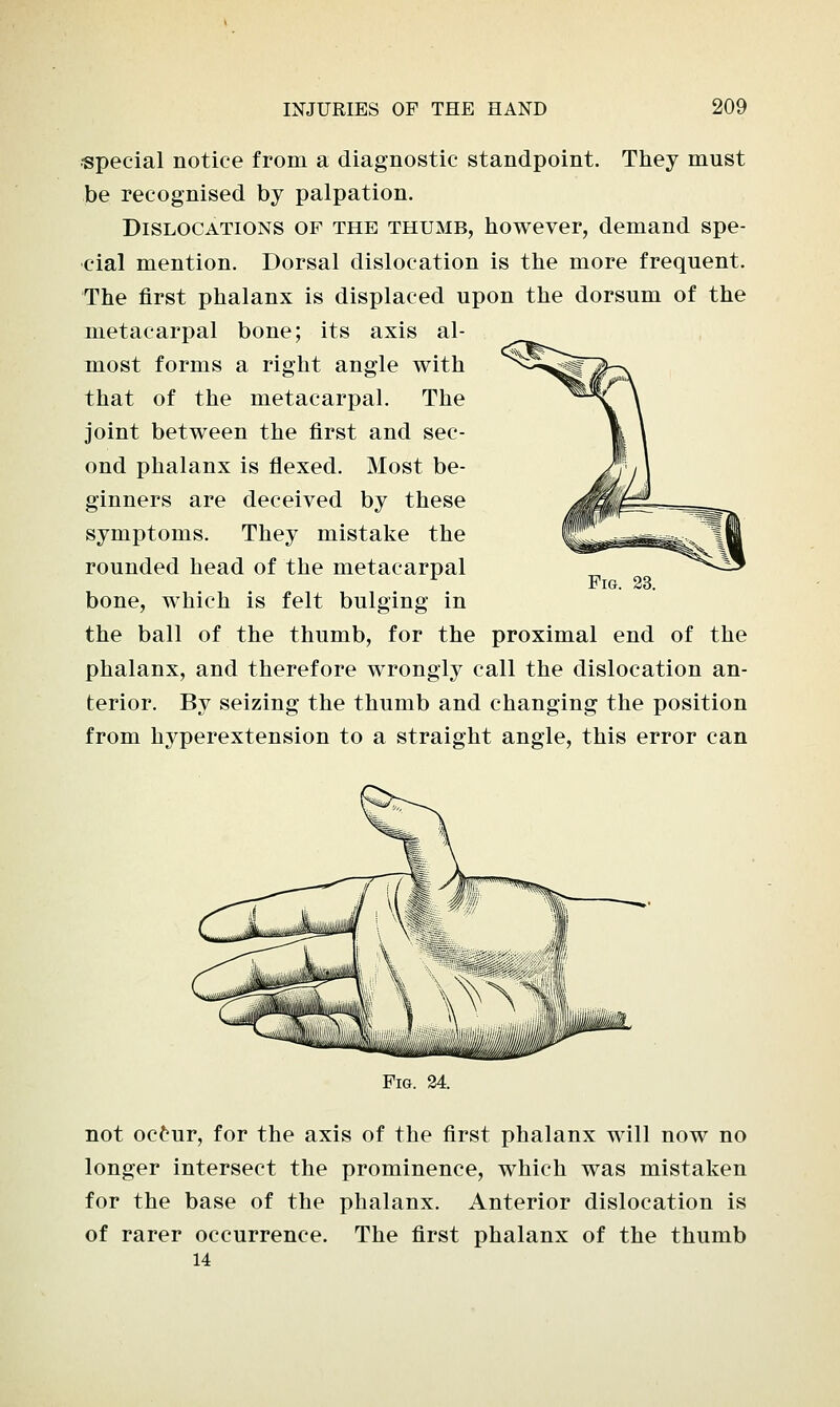 special notice from a diagnostic standpoint. They must be recognised by palpation. Dislocations of the thumb, however, demand spe- cial mention. Dorsal dislocation is the more frequent. The first phalanx is displaced upon the dorsum of the metacarpal bone; its axis al- most forms a right angle with that of the metacarpal. The joint between the first and sec- ond phalanx is flexed. Most be- ginners are deceived by these symptoms. They mistake the rounded head of the metacarpal bone, which is felt bulging in the ball of the thumb, for the proximal end of the phalanx, and therefore wrongly call the dislocation an- terior. By seizing the thumb and changing the position from hyperextension to a straight angle, this error can Fig. 23. Fig. 24. not oc£ur, for the axis of the first phalanx will now no longer intersect the prominence, which was mistaken for the base of the phalanx. Anterior dislocation is of rarer occurrence. The first phalanx of the thumb 14