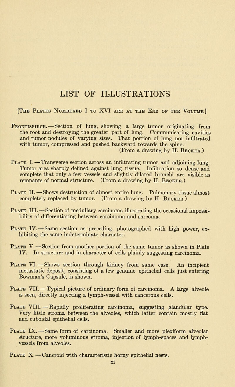 LIST OF ILLUSTRATIONS [The Plates Numbered I to XVI are at the End op the Volume] Frontispiece. — Section of lung, showing a large tumor originating from the root and destroying the greater part of lung. Communicating cavities and tumor nodules of varying sizes. That portion of lung not infiltrated with tumor, compressed and pushed backward towards the spine. (From a drawing by H. Becker.) Plate I.—Transverse section across an infiltrating tumor and adjoining lung. Tumor area sharply defined against lung tissue. Infiltration so dense and complete that only a few vessels and slightly dilated bronchi are visible as remnants of normal structure. (From a drawing by H. Becker.) Plate II. — Shows destruction of almost entire lung. Pulmonary tissue almost completely replaced by tumor. (From a drawing by H. Becker.) Plate III. — Section of medullary carcinoma illustrating the occasional impossi- bihty of differentiating between carcinoma and sarcoma. Plate IV.—Same section as preceding, photographed with high power, ex- hibiting the same indeterminate character. Plate V.—Section from another portion of the same tumor as shown in Plate IV. In structure and in character of cells plainly suggesting carcinoma. Plate VI.—Shows section through kidney from same case. An incipient metastatic deposit, consisting of a few genuine epithelial cells just entering Bowman's Capsule, is shown. Plate VII. — Typical picture of ordinary form of carcinoma. A large alveole is seen, directly injecting a lymph-vessel with cancerous cells. Plate VIII. — Rapidly proUferating carcinoma, suggesting glandular type. Very little stroma between the alveoles, which latter contain mostly flat and cuboidal epithelial cells. Plate IX. — Same form of carcinoma. Smaller and more plexiform alveolar structure, more voluminous stroma, injection of lymph-spaces and lymph- vessels from alveoles. Plate X.—Cancroid with characteristic homy epithelial nests.