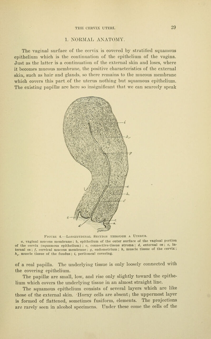 1. NORMAL ANATOMY. The vagina] surface of the cervix is covered by stratified squamous epithelium which is the continuation of the epithelium of the vagina. Just as the latter is a continuation of the external skin and loses, where it becomes mucous membrane, the positive characteristics of the external skin, such as hair and glands, so there remains to the mucous membrane which covers this part of the uterus nothing but squamous epithelium. The existing papillae are here so insignificant that we can scarcely speak Figure 4.—Longitudinal Section through a Uterus. a, vaginal mucous membrane; b, epithelium of the outer surface of the vaginal portion of the cervix (squamous epithelium) ; c, connective-tissue stroma; d, external os; e, In- ternal os ; f, cervical mucous membrane; g, endometrium; h, muscle tissue of the cervix; h^ muscle tissue of the fundus ; i, peritoneal covering. of a real papilla. The underlying tissue is only loosely connected with the covering epithelium. The papillae are small, low, and rise only slightly toward the epithe- lium which covers the underlying tissue in an almost straight line. The squamous epithelium consists of several layers which are like those of the external skin. Horny cells are absent; the uppermost layer is formed of flattened, sometimes fusiform, elements. The projections are rarely seen in alcohol specimens. Under these come the cells of the