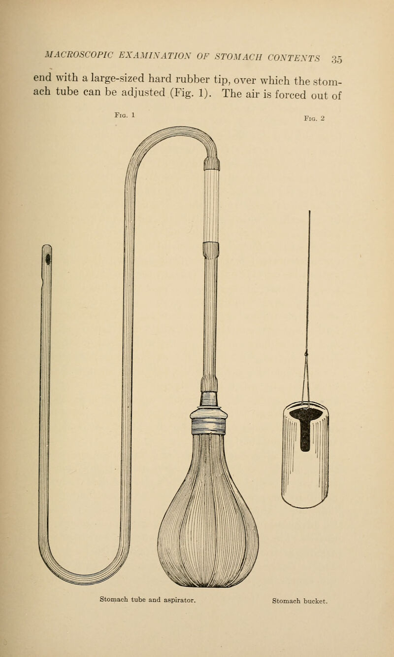 end with a large-sized hard rubber tip, over which the stom- ach tube can be adjusted (Fig. 1). The air is forced out of Fig. 1 Fig. 2 Stomach tube and aspirator. Stomach bucket.