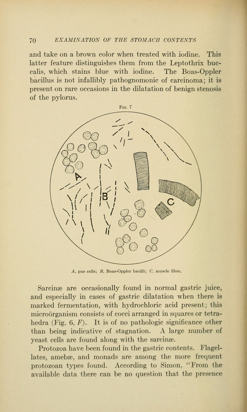 and take on a brown color when treated with iodine. This latter feature distinguishes them from the Leptothrix bue- calis, which stains blue with iodine. The Boas-Oppler bacillus is not infalhbly pathognomonic of carcinoma; it is present on rare occasions in the dilatation of benign stenosis of the pylorus. Fig. 7 A, pus cells; B, Boas-Oppler bacilli; C, muscle fibre. Sarcinse are occasionally found in normal gastric juice, and especially in cases of gastric dilatation when there is marked fermentation, with hydrochloric acid present; this microorganism consists of cocci arranged in squares or tetra- hedra (Fig. 6, F). It is of no pathologic significance other than being indicative of stagnation. A large number of yeast cells are found along with the sarcinse. Protozoa have been found in the gastric contents. Flagel- lates, amebae, and monads are among the more fretiuent protozoan types found. According to Simon, From the available data there can be no question that the presence