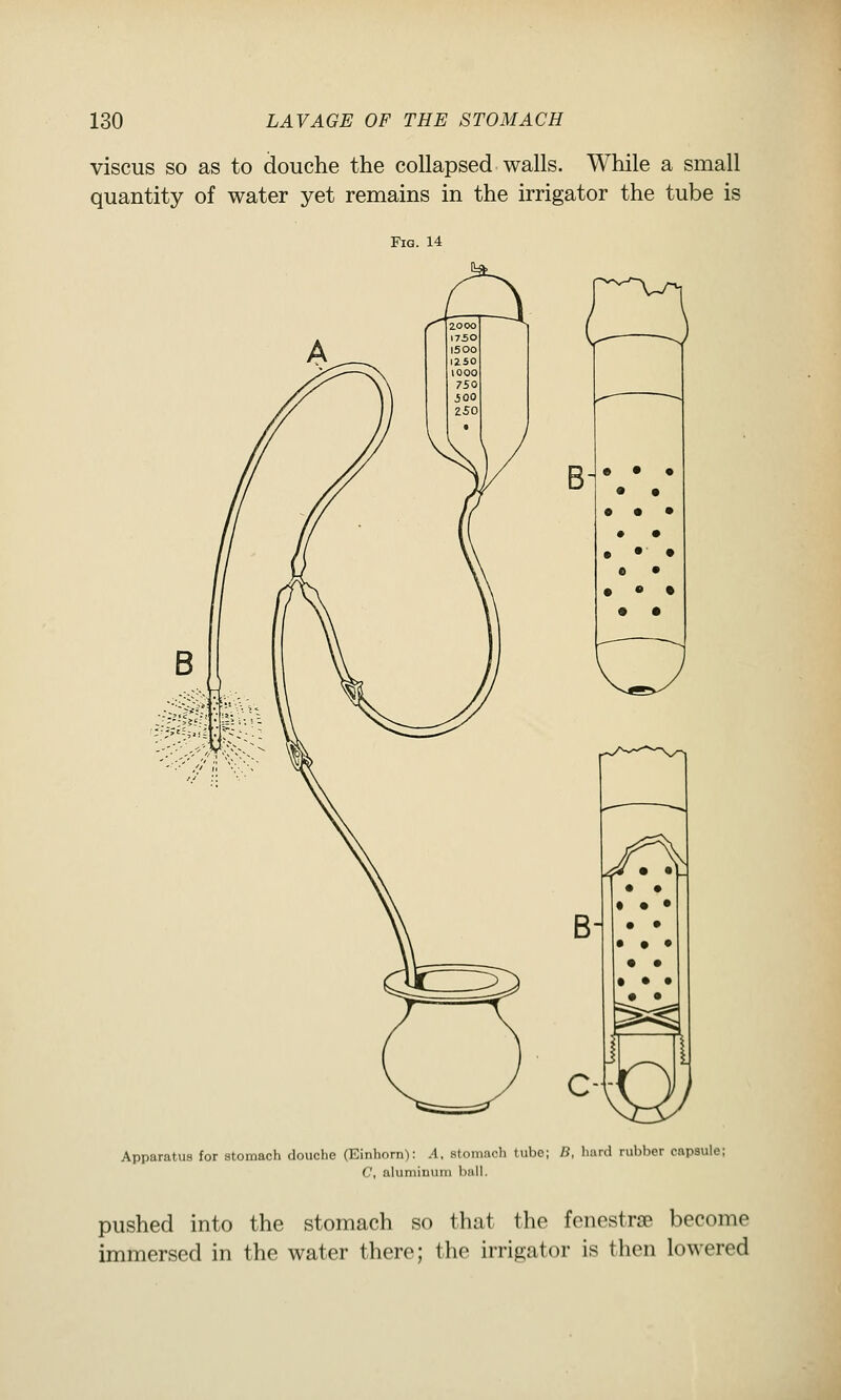 viscus SO as to douche the collapsed walls. While a small quantity of water yet remains in the irrigator the tube is Fig. 14 Apparatus for stomach douche (Einhorn): A, stomach tube; B, hard rubber capsule; C, aluminum ball. pushed into the stomach so that the fenestras become immersed in the water there; the irrigator is then lowered