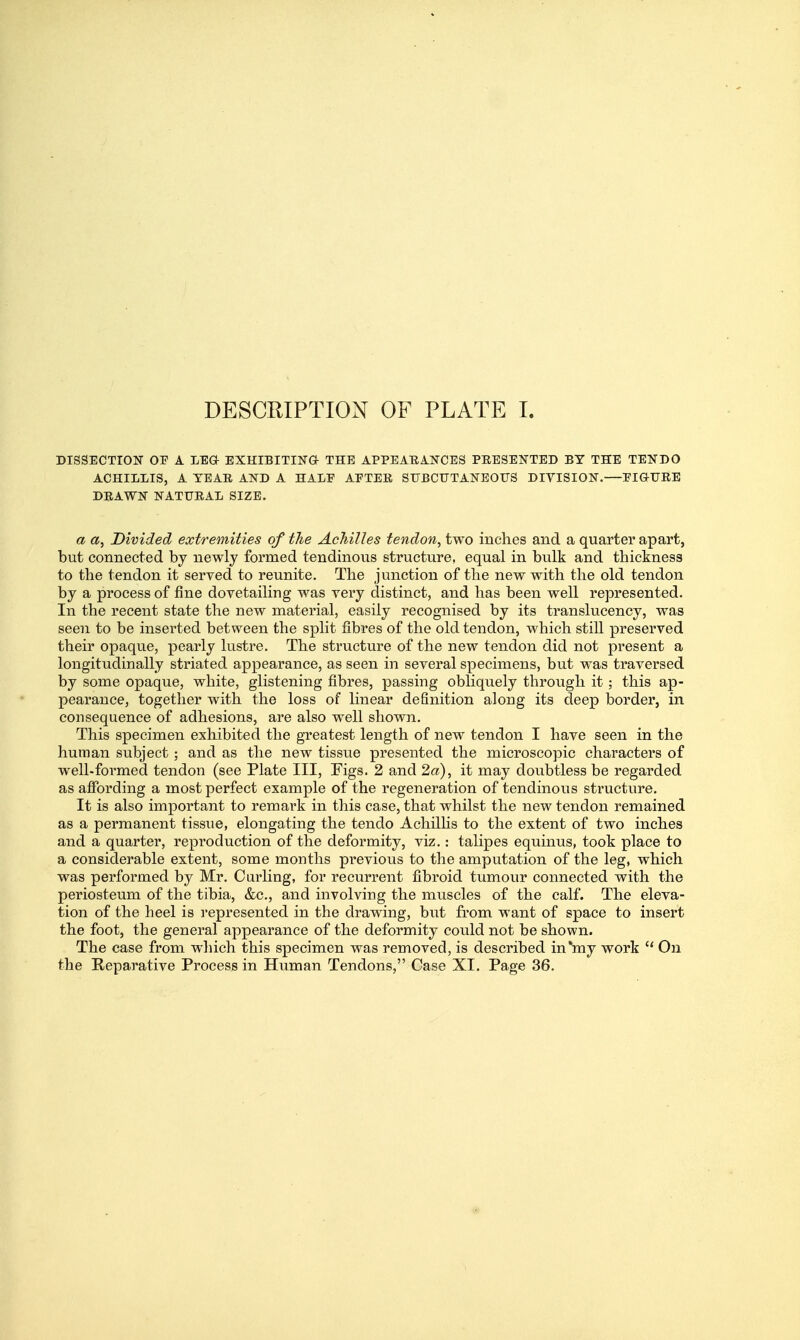 DISSECTION OF A LEG- EXHIBITING- THE APPEABANCES PRESENTED BY THE TENDO ACHILLIS, A TEAR AND A HALF AFTER SUBCUTANEOrS DIVISION.—FIGURE DRAWN NATURAL SIZE. a a, Divided extremities of the Achilles tendon, two inches and a quarter apart, but connected by newly formed tendinous structure, equal in bulk and thickness to the tendon it served to reunite. The junction of the new with the old tendon by a process of fine dovetailing was very distinct, and has been well represented. In the recent state the new material, easily recognised by its translucency, was seen to be inserted between the split fibres of the old tendon, which still preserved their opaque, pearly lustre. The structure of the new tendon did not present a longitudinally striated appearance, as seen in several specimens, but was traversed by some opaque, white, glistening fibres, passing obliquely through it; this ap- pearance, together with the loss of linear definition along its deep border, in consequence of adhesions, are also well shown. This specimen exhibited the greatest length of new tendon I have seen in the human subject ; and as the new tissue presented the microscopic characters of well-formed tendon (see Plate III, Figs. 2 and 2a), it may doubtless be regarded as affording a most perfect example of the regeneration of tendinous structure. It is also important to remark in this case, that whilst the new tendon remained as a permanent tissue, elongating the tendo Achillis to the extent of two inches and a quarter, reproduction of the deformity, viz.: talipes equinus, took place to a considerable extent, some months previous to the amputation of the leg, which was performed by Mr, Curling, for recurrent fibroid tumour connected with the periosteum of the tibia, &c., and involving the muscles of the calf. The eleva- tion of the heel is i-epresented in the drawing, but from want of space to insert the foot, the general appearance of the deformity could not be shown. The case from which this specimen was removed, is described in'my work  On the Reparative Process in Human Tendons, Case XI. Page 36.
