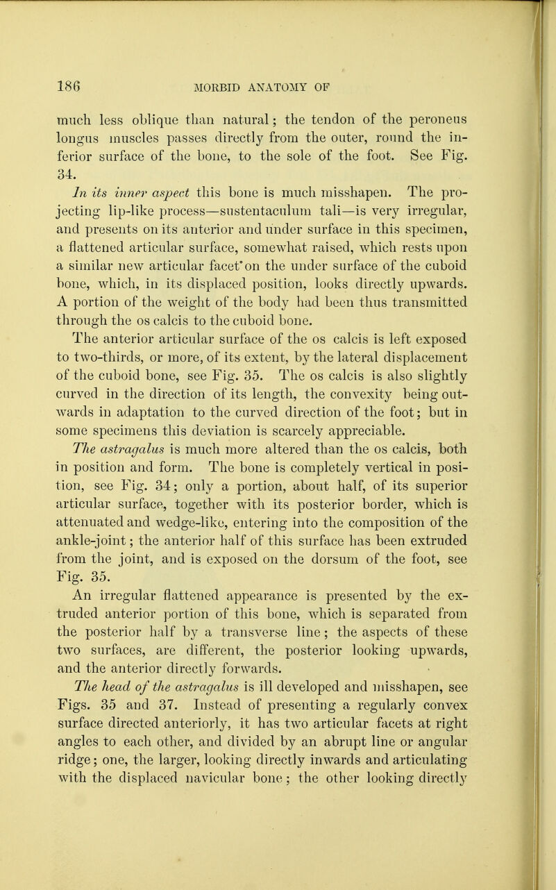 much less oblique than natural; the tendon of the peroneus longus muscles passes directly from the outer, round the in- ferior surface of the bone, to the sole of the foot. See Fig. 34. In its inner aspect this bone is much misshapen. The pro- jecting lip-like process—sustentaculum tali—is very irregular, and presents on its anterior and under surface in this specimen, a flattened articular surface, somewhat raised, which rests upon a similar new articular facet*on the under surface of the cuboid bone, which, in its displaced position, looks directly upwards. A portion of the weight of the body had been thus transmitted through the os calcis to the cuboid bone. The anterior articular surface of the os calcis is left exposed to two-thirds, or more, of its extent, by the lateral displacement of the cuboid bone, see Fig. 35. The os calcis is also slightly curved in the direction of its length, the convexity being out- wards in adaptation to the curved direction of the foot; but in some specimens this deviation is scarcely appreciable. The astragalus is much more altered than the os calcis, both in position and form. The bone is completely vertical in posi- tion, see Fig. 34; only a portion, about half, of its superior articular surface, together with its posterior border, which is attenuated and wedge-like, entering into the composition of the ankle-joint; the anterior half of this surface has been extruded from the joint, and is exposed on the dorsum of the foot, see Fig. 35. An irregular flattened appearance is presented by the ex- truded anterior portion of this bone, which is separated from the posterior half by a transverse line; the aspects of these two surfaces, are different, the posterior looking upwards, and the anterior directly forwards. The head of the astragalus is ill developed and misshapen, see Figs. 35 and 37. Instead of presenting a regularly convex surface directed anteriorly, it has two articular facets at right angles to each other, and divided by an abrupt line or angular ridge; one, the larger, looking directly inwards and articulating with the displaced navicular bone; the other looking directly
