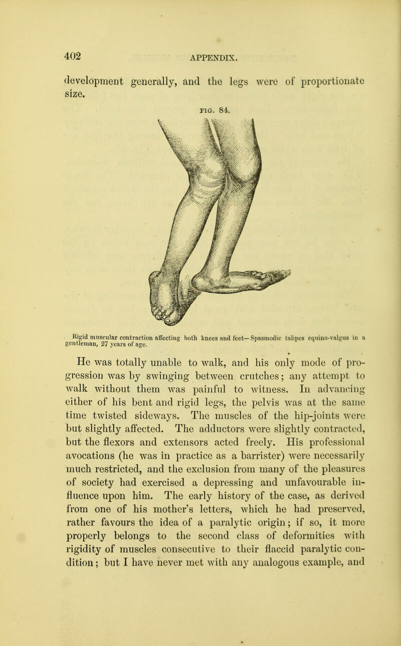 development generally, and the legs were of proportionate -Rigid muscular contraction affecting both knees and feet—Spasmodic talipes eqnino-valgus iu a gentleman, 37 years of age. He was totally unable to walk, and his only mode of pro- gression was by swinging between crutches; any attempt to walk without them was painful to witness. In advancing either of his bent and rigid legs, the pelvis was at the same time twisted sideways. The muscles of the hip-joints were but slightly affected. The adductors were slightly contracted, but the flexors and extensors acted freely. His professional avocations (he was in practice as a barrister) were necessarily much restricted, and the exclusion from many of the pleasures of society had exercised a depressing and unfavourable in- fluence upon him. The early history of the case, as derived from one of his mother's letters, which he had preserved, rather favours the idea of a paralytic origin; if so, it more properly belongs to the second class of deformities with rigidity of muscles consecutive to their flaccid paralytic con- dition ; but I have never met with any analogous example, and size. riG. 84.