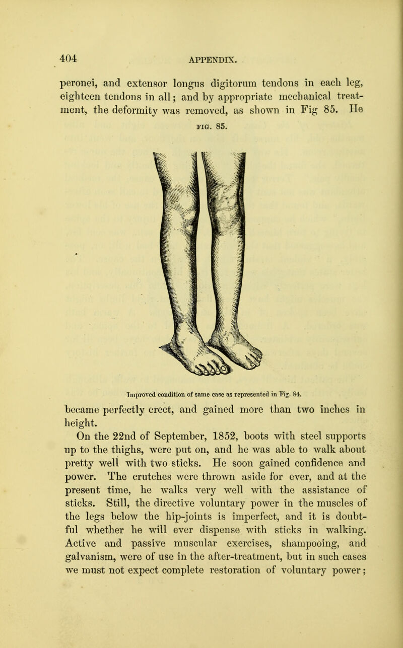 peronei, and extensor longus digitorum tendons in each leg, eighteen tendons in all; and by appropriate mechanical treat- ment, the deformity was removed, as shown in Fig 85. He FIG. 85. Improved condition of same case as represented in Fig. 84. became perfectly erect, and gained more than two inches in height. On the 22nd of September, 1852, boots with steel supports np to the thighs, were put on, and he was able to walk about pretty well with two sticks. He soon gained confidence and power. The crutches were thrown aside for ever, and at the present time, he walks very well with the assistance of sticks. Still, the directive voluntary power in the muscles of the legs below the hip-joints is imperfect, and it is doubt- ful whether he will ever dispense with sticks in walking. Active and passive muscular exercises, shampooing, and galvanism, were of use in the after-treatment, but in such cases we must not expect complete restoration of voluntary power;