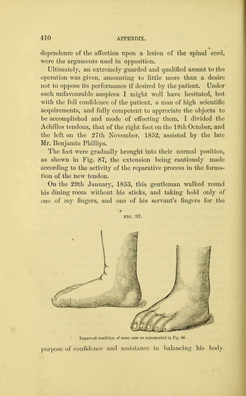 dependence of the affection upon a lesion of the spinal cord, were the arguments used in opposition. Ultimately, an extremely guarded and qualified assent to the operation was given, amounting to little more than a desire not to oppose its performance if desired by the patient. Under such unfavourable auspices I might well have hesitated, but with the full confidence of the patient, a man of high scientific acquirements, and fully competent to appreciate the objects to be accomplished and mode of effecting them, I divided the Achilles tendons, that of the right foot on the 18th October, and the left on the 27th November, 1852, assisted by the late Mr. Benjamin Phillips. The feet were gradually brought into their normal position, as shown in Fig. 87, the extension being cautiously made according to the activity of the reparative process in the forma- tion of the new tendon. On the 29th January, 1853, this gentleman walked round his dining room without his sticks, and taking hold only of one of my fingers, and one of his servant's fingers for the riG, 87. Improved condition of same case as represented in Fig. 86. purpose of confidence and assistance in balancing his body.