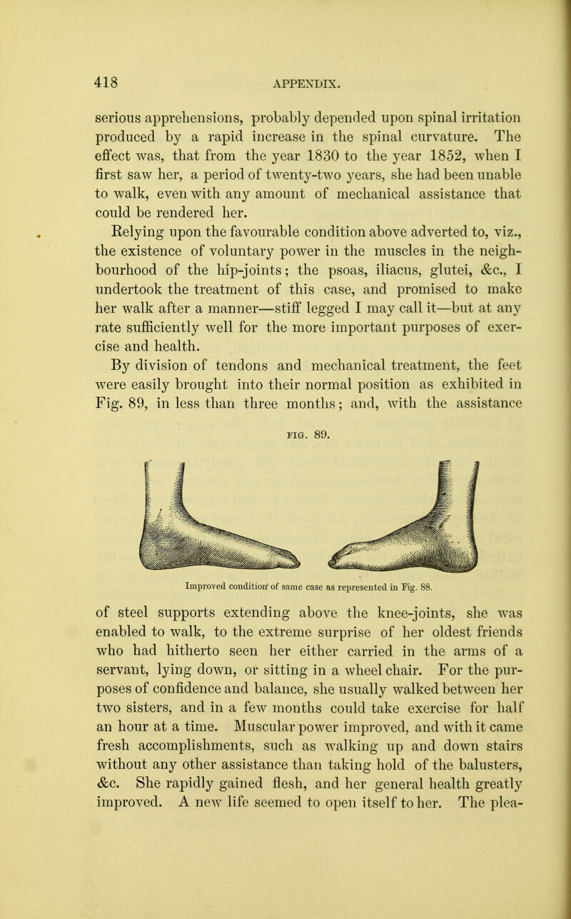 serious apprehensions, probably depended upon spinal irritation produced by a rapid increase in the spinal curvature. The effect was, that from the year 1830 to the year 1852, when I first saw her, a period of twenty-two years, she had been unable to walk, even with any amount of mechanical assistance that could be rendered her. Eelying upon the favourable condition above adverted to, viz., the existence of voluntary power in the muscles in the neigh- bourhood of the hip-joints; the psoas, iliacus, glutei, &c., I undertook the treatment of this case, and promised to make her walk after a manner—stiff legged I may call it—but at any rate sufficiently well for the more important purposes of exer- cise and health. By division of tendons and mechanical treatment, the feet were easily brought into their normal position as exhibited in Fig. 89, in less than three months; and, with the assistance FIG. 89. Improved condition of same case as represented in Fig. 88. of steel supports extending above the knee-joints, she was enabled to walk, to the extreme surprise of her oldest friends who had hitherto seen her either carried in the arms of a servant, lying down, or sitting in a wheel chair. For the pur- poses of confidence and balance, she usually walked between her two sisters, and in a few months could take exercise for half an hour at a time. Muscular power improved, and with it came fresh accomplishments, such as walking up and down stairs without any other assistance than taking hold of the balusters, &c. She rapidly gained flesh, and her general health greatly improved. A new life seemed to open itself to her. The plea-