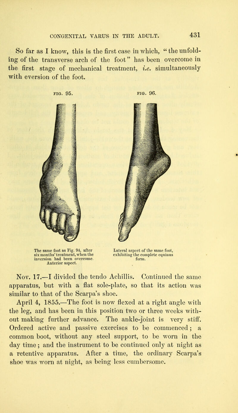 So far as I know, this is the first case in which,  the unfold- ing of the transverse arch of the foot has been overcome in the first stage of mechanical treatment, i.e, simultaneously with eversion of the foot. FIG. 95. Fia. 96. The same foot as Pig. 94, after Lateral aspect of the same foot, six months' treatment, when the exhibiting the complete equinus inversion had been overcome. form. Anterior aspect. Nov. 17.—I divided the tendo Achillis. Continued the same apparatus, but with a flat sole-plate, so that its action was similar to that of the Scarpa's shoe. April 4, 1855.—The foot is now flexed at a right angle with the leg, and has been in this position two or three weeks with- out making further advance. The ankle-joint is very stiff. Ordered active and passive exercises to be commenced; a common boot, without any steel support, to be worn in the day time; and the instrument to be continued only at night as a retentive apparatus. After a time, the ordinary Scarpa's shoe was worn at night, as being less cumbersome.