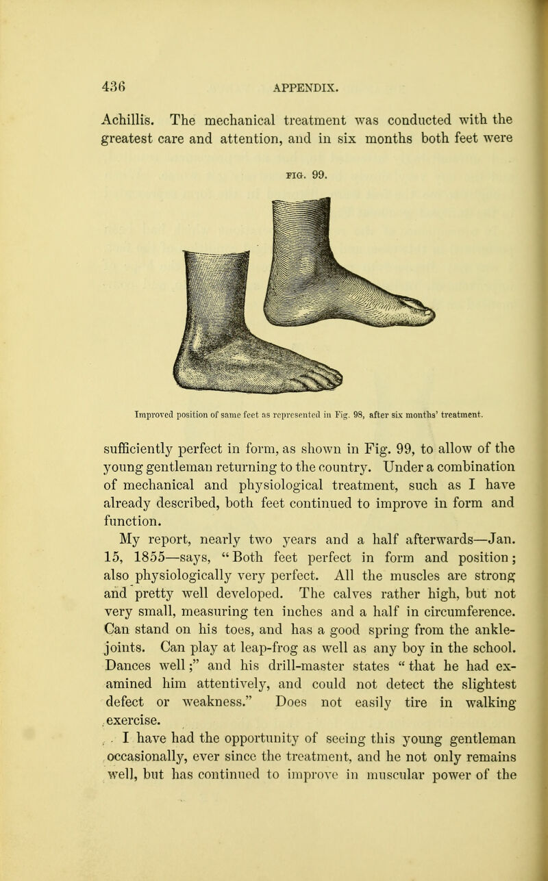 Achillis. The mechanical treatment was conducted with the greatest care and attention, and in six months both feet were Fia. 99. Improved position of same feet as represented in Fig. 98, after six months' treatment. sufficiently perfect in form, as shown in Fig. 99, to allow of the young gentleman returning to the country. Under a combination of mechanical and physiological treatment, such as I have already described, both feet continued to improve in form and function. My report, nearly two years and a half afterwards—Jan. 15, 1855—says, Both feet perfect in form and position; also physiologically very perfect. All the muscles are strong and pretty well developed. The calves rather high, but not very small, measuring ten inches and a half in circumference. Can stand on his toes, and has a good spring from the ankle- joints. Can play at leap-frog as well as any boy in the school. Dances well; and his drill-master states that he had ex- amined him attentively, and could not detect the slightest defect or weakness. Does not easily tire in walking , exercise. , . I have had the opportunity of seeing this young gentleman .occasionally, ever since the treatment, and he not only remains well, but has continued to improve in muscular power of the