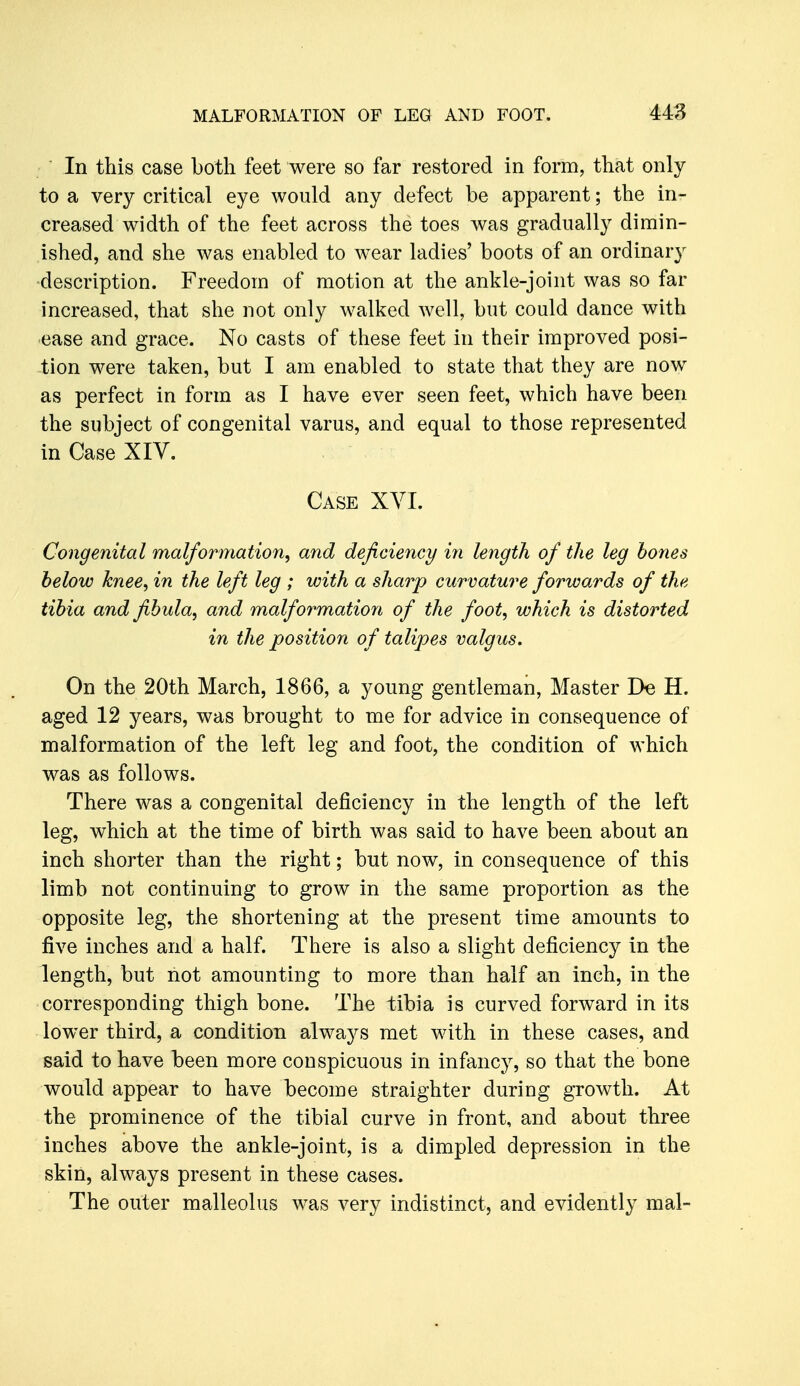 In this case both feet were so far restored in form, that only to a very critical eye would any defect be apparent; the in- creased width of the feet across the toes was gradually dimin- ished, and she was enabled to wear ladies' boots of an ordinary ■description. Freedom of motion at the ankle-joint was so far increased, that she not only walked well, but could dance with ease and grace. No casts of these feet in their improved posi- tion were taken, but I am enabled to state that they are now as perfect in form as I have ever seen feet, which have been the subject of congenital varus, and equal to those represented in Case XIV. Case XYI. Congenital malformation^ and deficiency in length of the leg hones below knee^ in the left leg ; with a sharp curvature forwards of the tibia and fibula^ and malformation of the foot, which is distorted in the position of talipes valgus. On the 20th March, 1866, a young gentleman, Master De H. aged 12 years, was brought to me for advice in consequence of malformation of the left leg and foot, the condition of which was as follows. There was a congenital deficiency in the length of the left leg, which at the time of birth was said to have been about an inch shorter than the right; but now, in consequence of this limb not continuing to grow in the same proportion as the opposite leg, the shortening at the present time amounts to five inches and a half. There is also a slight deficiency in the length, but not amounting to more than half an inch, in the corresponding thigh bone. The tibia is curved forward in its lower third, a condition always met with in these cases, and said to have been more conspicuous in infancy, so that the bone would appear to have become straighter during growth. At the prominence of the tibial curve in front, and about three inches above the ankle-joint, is a dimpled depression in the skin, always present in these cases. The outer malleolus was very indistinct, and evidently mal-