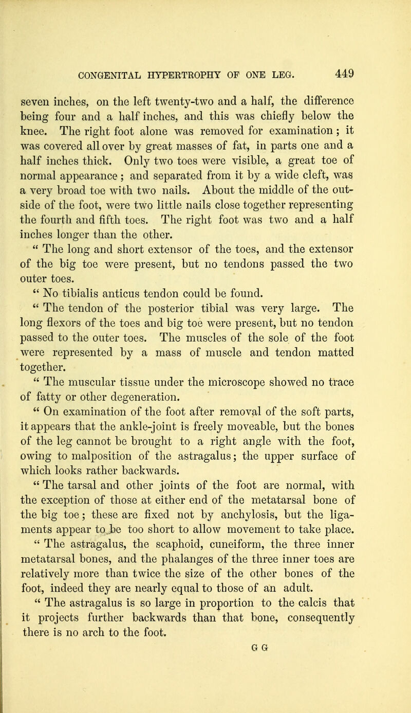 seven inches, on the left twenty-two and a half, the difference being four and a half inches, and this was chiefly below the knee. The right foot alone was removed for examination ; it was covered all over by great masses of fat, in parts one and a half inches thick. Only two toes were visible, a great toe of normal appearance; and separated from it by a wide cleft, was a very broad toe with two nails. About the middle of the out- side of the foot, were two little nails close together representing the fourth and fifth toes. The right foot was two and a half inches longer than the other.  The long and short extensor of the toes, and the extensor of the big toe were present, but no tendons passed the two outer toes. No tibialis anticus tendon could be found.  The tendon of the posterior tibial was very large. The long flexors of the toes and big toe were present, but no tendon passed to the outer toes. The muscles of the sole of the foot were represented by a mass of muscle and tendon matted together.  The muscular tissue under the microscope showed no trace of fatty or other degeneration.  On examination of the foot after removal of the soft parts, it appears that the ankle-joint is freely moveable, but the bones of the leg cannot be brought to a right angle with the foot, owing to malposition of the astragalus; the upper surface of which looks rather backwards.  The tarsal and other joints of the foot are normal, with the exception of those at either end of the metatarsal bone of the big toe; these are fixed not by anchylosis, but the liga- ments appear to^ibe too short to allow movement to take place.  The astragalus, the scaphoid, cuneiform, the three inner metatarsal bones, and the phalanges of the three inner toes are relatively more than twice the size of the other bones of the foot, indeed they are nearly equal to those of an adult.  The astragalus is so large in proportion to the calcis that it projects further backwards than that bone, consequently there is no arch to the foot. GG