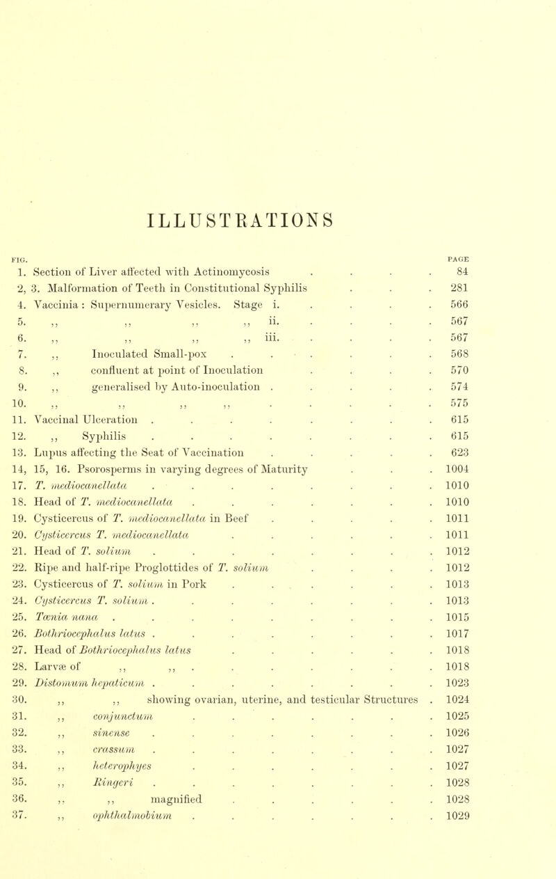 ILLUSTRATIONS FIG. PAGE 1. Section of Liver affected with Actinomycosis . . . .84 2, 3. Malformation of Teeth in Constitutional Syphilis . . . 281 4. Vaccinia: Supernumerary Vesicles. Stage i. . . . . 566 5. ,, ,, ii. . . . . 567 6. ,, iii. .... 567 7. Inoculated Small-pox . . • . . . . 568 8. ,, confluent at point of Inoculation .... 570 9. generalised by Auto-inoculation ..... 574 10. 575 11. Vaccinal Ulceration .... .... 615 12. Syphilis ........ 615 13. Lupus affecting the Seat of Vaccination ..... 623 14. 15, 16. Psorosperms in varying degrees of Maturity . . . 1004 17. T. mediocanellata ........ 1010 18. Head of T. mediocanellata ....... 1010 19. Cysticercus of T. mediocanellata in Beef ..... 1011 20. Cysticercus T. mediocanellata . . . . . .1011 21. Head of T. solium ........ 1012 22. Ripe and half-ripe Proglottides of 2\ solium .... 1012 23. Cysticercus of T. solium in Pork ...... 1013 24. Cysticercus T. solium . . . . . . . .1013 25. Taenia nana ......... 1015 26. Bothriocephalus latus ........ 1017 27. Head Bothriocepludus latus ...... 1018 28. Larvffiof „ 1018 29. Distomum hepaticum ........ 1023 30. 5, showing ovarian, uterine, and testicular Structures . 1024 31. ,, conjunctum ....... 1025 32. sinense ........ 1026 33. crassum ........ 1027 34. ,, heterophyes ....... 1027 35. Fdngeri ........ 1028 36. ,, magnified ...... 1028 37. ,, ophthalmohium ....... 1029