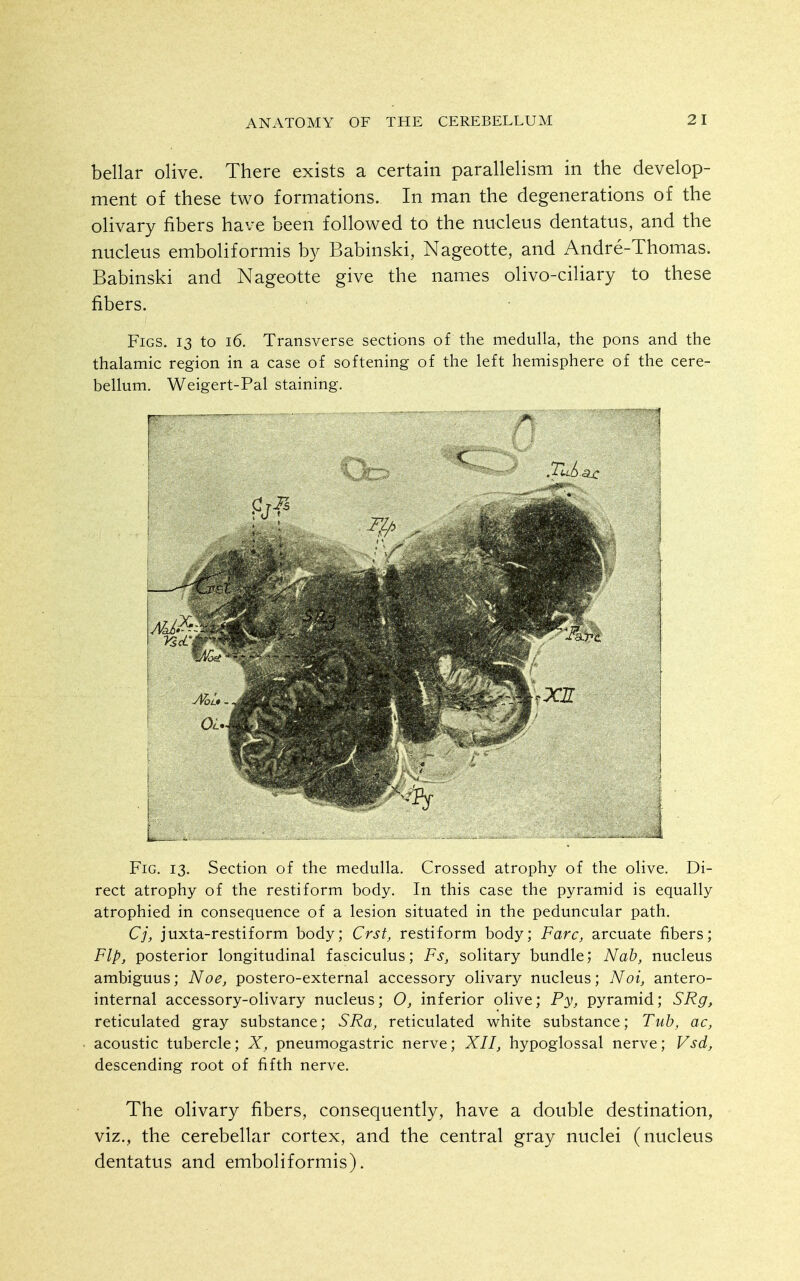 bellar olive. There exists a certain parallelism in the develop- ment of these two formations. In man the degenerations of the olivary fibers have been followed to the nucleus dentatus, and the nucleus emboliformis by Babinski, Nageotte, and Andre-Thomas. Babinski and Nageotte give the names olivo-ciliary to these fibers. Figs. 13 to 16. Transverse sections of the medulla, the pons and the thalamic region in a case of softening of the left hemisphere of the cere- bellum. Weigert-Pal staining. Fig. 13. Section of the medulla. Crossed atrophy of the olive. Di- rect atrophy of the restiform body. In this case the pyramid is equally atrophied in consequence of a lesion situated in the peduncular path. Cj, juxta-restiform body; Crst, restiform body; Fare, arcuate fibers; Flp, posterior longitudinal fasciculus; Fs, solitary bundle; Nab, nucleus ambiguus; Noe, postero-external accessory olivary nucleus; Noi, antero- internal accessory-olivary nucleus; O, inferior olive; Py, pyramid; SRg, reticulated gray substance; SRa, reticulated white substance; Tub, ac, acoustic tubercle; X, pneumogastric nerve; XII, hypoglossal nerve; Vsd, descending root of fifth nerve. The olivary fibers, consequently, have a double destination, viz., the cerebellar cortex, and the central gray nuclei (nucleus dentatus and emboliformis).