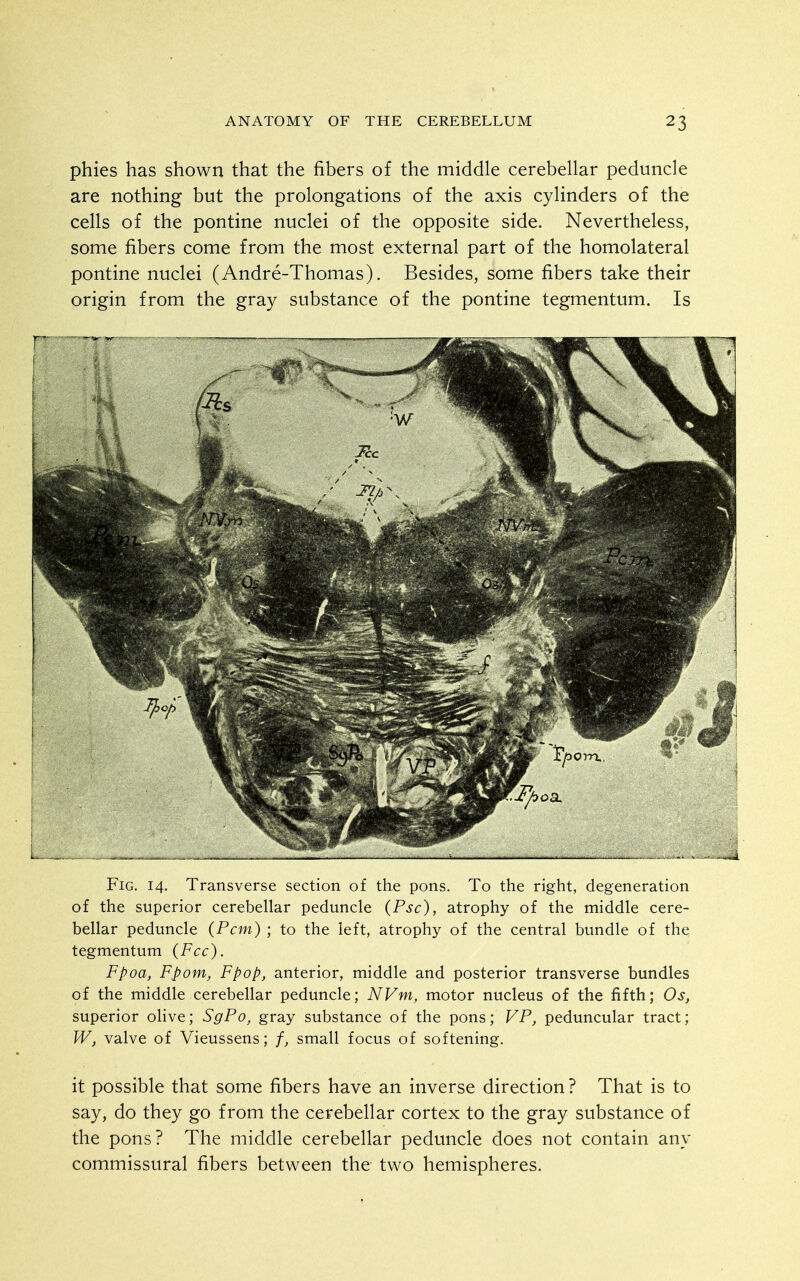 phies has shown that the fibers of the middle cerebellar peduncle are nothing but the prolongations of the axis cylinders of the cells of the pontine nuclei of the opposite side. Nevertheless, some fibers come from the most external part of the homolateral pontine nuclei (Andre-Thomas). Besides, some fibers take their origin from the gray substance of the pontine tegmentum. Is Fig. 14. Transverse section of the pons. To the right, degeneration of the superior cerebellar peduncle (Psc), atrophy of the middle cere- bellar peduncle (Pern) ; to the left, atrophy of the central bundle of the tegmentum (Fee). Fpoa, Fpom, Fpop, anterior, middle and posterior transverse bundles of the middle cerebellar peduncle; NVm, motor nucleus of the fifth; Os, superior olive; SgPo, gray substance of the pons; VP, peduncular tract; W, valve of Vieussens; small focus of softening. it possible that some fibers have an inverse direction ? That is to say, do they go from the cerebellar cortex to the gray substance of the pons? The middle cerebellar peduncle does not contain any commissural fibers between the two hemispheres.