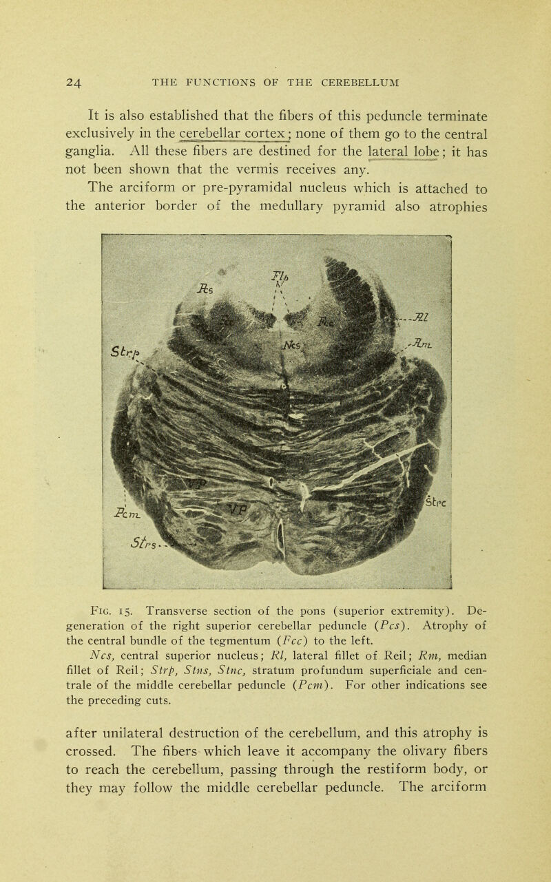 It is also established that the fibers of this peduncle terminate exclusively in the cerebellar cortex; none of them go to the central ganglia. All these fibers are destined for the lateral lobe; it has not been shown that the vermis receives any. The arciform or pre-pyramidal nucleus which is attached to the anterior border of the medullary pyramid also atrophies Fig. 15. Transverse section of the pons (superior extremity). De- generation of the right superior cerebellar peduncle (Pes). Atrophy of the central bundle of the tegmentum (Fee) to the left. Nes, central superior nucleus; Rl, lateral fillet of Reil; Rnij median fillet of Reil; Strp^ Stns, Sine, stratum profundum superficiale and cen- trale of the middle cerebellar peduncle (Pern). For other indications see the preceding cuts. after unilateral destruction of the cerebellum, and this atrophy is crossed. The fibers which leave it accompany the olivary fibers to reach the cerebellum, passing through the restiform body, or they may follow the middle cerebellar peduncle. The arciform