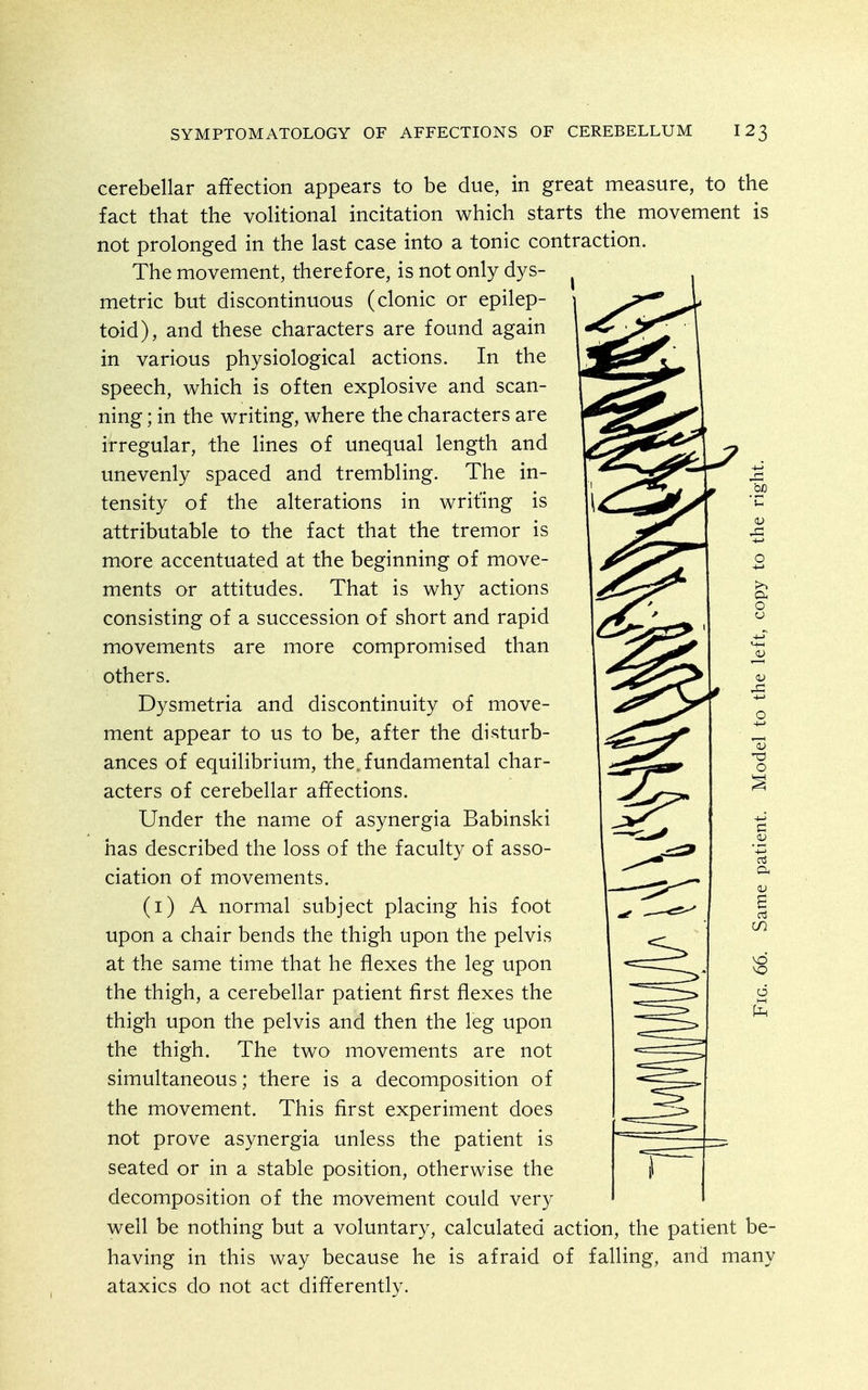 cerebellar affection appears to be due, in great measure, to the fact that the volitional incitation which starts the movement is not prolonged in the last case into a tonic contraction. The movement, therefore, is not only dys- metric but discontinuous (clonic or epilep- toid), and these characters are found again in various physiological actions. In the speech, which is often explosive and scan- ning ; in the writing, where the characters are irregular, the lines of unequal length and unevenly spaced and trembling. The in- tensity of the alterations in writing is attributable to the fact that the tremor is more accentuated at the beginning of move- ments or attitudes. That is why actions consisting of a succession of short and rapid movements are more compromised than others. Dysmetria and discontinuity of move- ment appear to us to be, after the disturb- ances of equilibrium, the, fundamental char- acters of cerebellar affections. Under the name of asynergia Babinski has described the loss of the faculty of asso- ciation of movements. (i) A normal subject placing his foot upon a chair bends the thigh upon the pelvis at the same time that he flexes the leg upon the thigh, a cerebellar patient first flexes the thigh upon the pelvis and then the leg upon the thigh. The two movements are not simultaneous; there is a decomposition of the movement. This first experiment does not prove asynergia unless the patient is seated or in a stable position, otherwise the decomposition of the movement could very well be nothing but a voluntary, calculated action, the patient be- having in this way because he is afraid of falling, and many ataxics do not act differently.