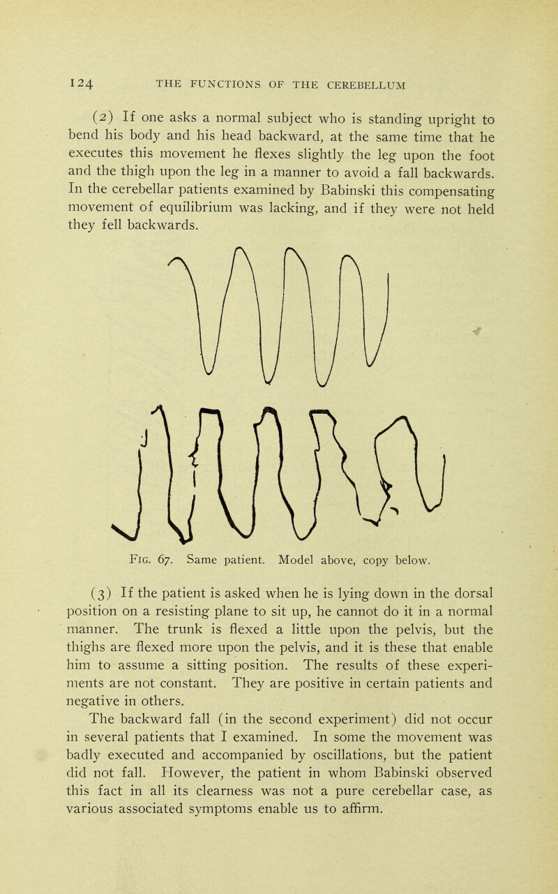 (2) If one asks a normal subject who is standing upright to bend his body and his head backward, at the same time that he executes this movement he flexes sHghtly the leg upon the foot and the thigh upon the leg in a manner to avoid a fall backwards. In the cerebellar patients examined by Babinski this compensating movement of equilibrium was lacking, and if they were not held they fell backwards. Fig. 67. Same patient. Model above, copy below. (3) If the patient is asked when he is lying down in the dorsal position on a resisting plane to sit up, he cannot do it in a normal manner. The trunk is flexed a little upon the pelvis, but the thighs are flexed more upon the pelvis, and it is these that enable him to assume a sitting position. The results of these experi- ments are not constant. They are positive in certain patients and negative in others. The backward fall (in the second experiment) did not occur in several patients that I examined. In some the movement was badly executed and accompanied by oscillations, but the patient did not fall. However, the patient in whom Babinski observed this fact in all its clearness was not a pure cerebellar case, as various associated symptoms enable us to aflirm.