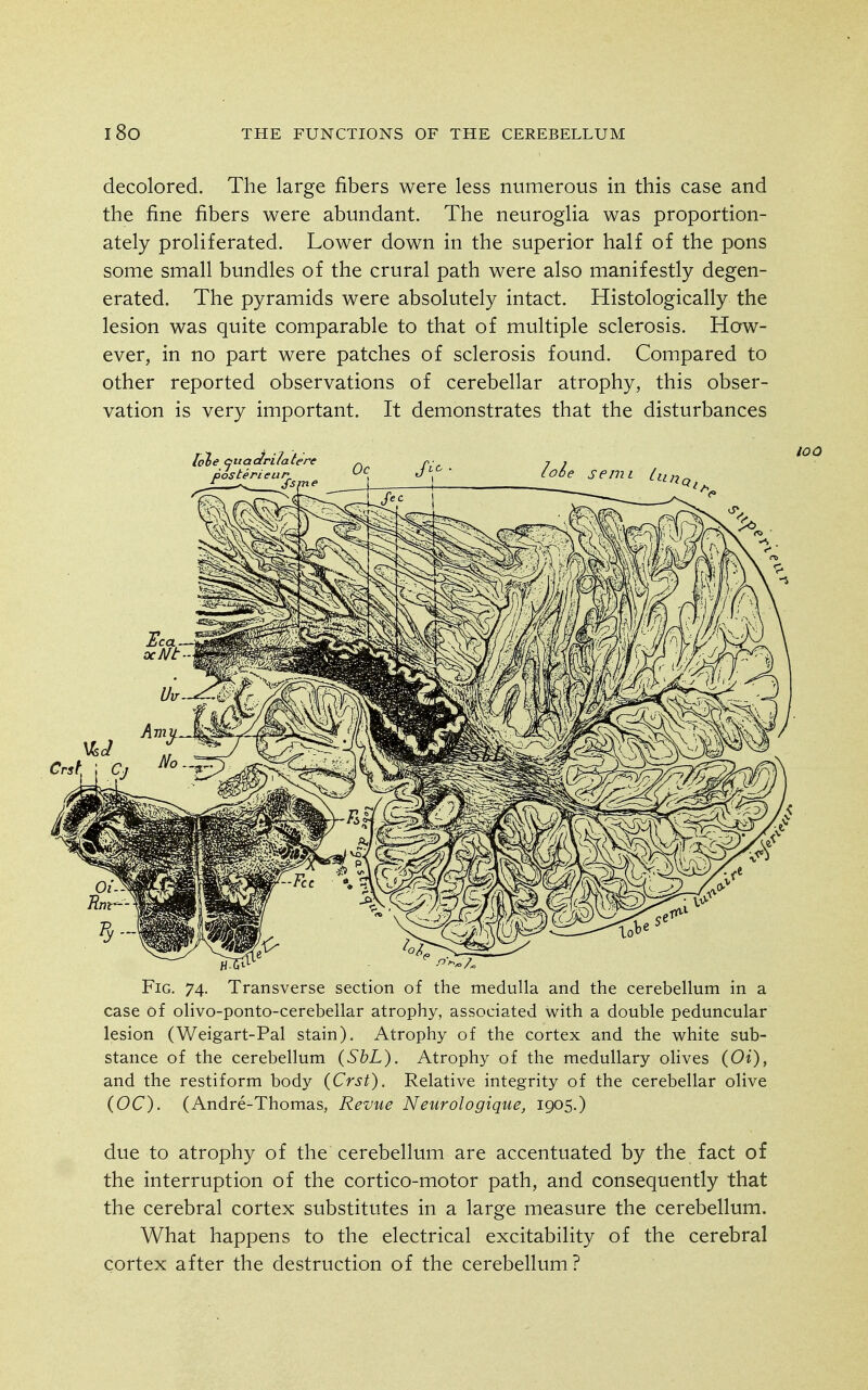 decolored. The large fibers were less numerous in this case and the fine fibers were abundant. The neuroglia was proportion- ately proliferated. Lower down in the superior half of the pons some small bundles of the crural path were also manifestly degen- erated. The pyramids were absolutely intact. Histologically the lesion was quite comparable to that of multiple sclerosis. How- ever, in no part were patches of sclerosis found. Compared to other reported observations of cerebellar atrophy, this obser- vation is very important. It demonstrates that the disturbances Fig. 74. Transverse section of the medulla and the cerebellum in a case of olivo-ponto-cerebellar atrophy, associated with a double peduncular lesion (Weigart-Pal stain). Atrophy of the cortex and the white sub- stance of the cerebellum (SbL). Atrophy of the medullary olives (Oi), and the restiform body (Crst). Relative integrity of the cerebellar olive (OC). (Andre-Thomas, Revue Neurologique, 1905.) due to atrophy of the cerebellum are accentuated by the fact of the interruption of the cortico-motor path, and consequently that the cerebral cortex substitutes in a large measure the cerebellum. What happens to the electrical excitability of the cerebral cortex after the destruction of the cerebellum?