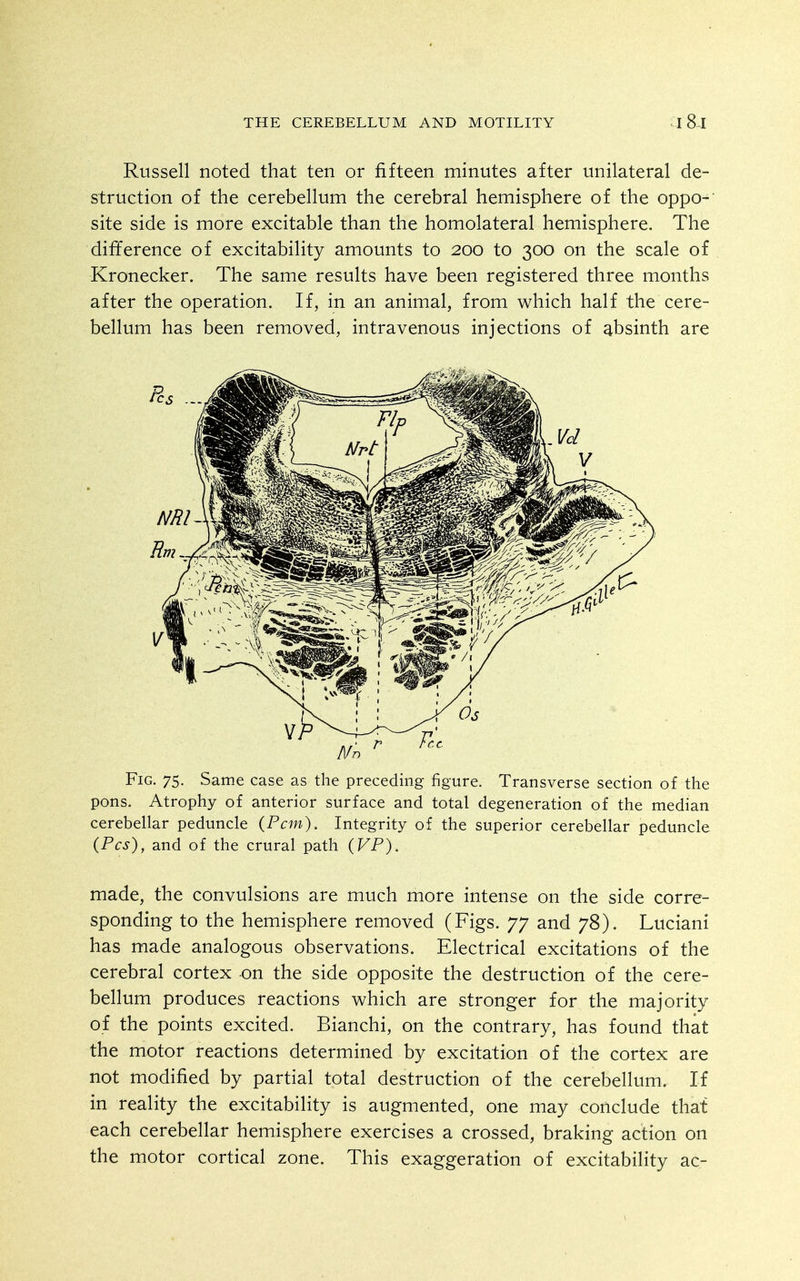 Russell noted that ten or fifteen minutes after unilateral de- struction of the cerebellum the cerebral hemisphere of the oppo-' site side is more excitable than the homolateral hemisphere. The difference of excitability amounts to 200 to 300 on the scale of Kronecker. The same results have been registered three months after the operation. If, in an animal, from which half the cere- bellum has been removed, intravenous injections of absinth are Fig. 75. Same case as the preceding figure. Transverse section of the pons. Atrophy of anterior surface and total degeneration of the median cerebellar peduncle (Pern). Integrity of the superior cerebellar peduncle (Pes), and of the crural path (VP). made, the convulsions are much more intense on the side corre- sponding to the hemisphere removed (Figs. 77 and 78). Luciani has made analogous observations. Electrical excitations of the cerebral cortex on the side opposite the destruction of the cere- bellum produces reactions which are stronger for the majority of the points excited. Bianchi, on the contrary, has found that the motor reactions determined by excitation of the cortex are not modified by partial total destruction of the cerebellum. If in reality the excitability is augmented, one may conclude that each cerebellar hemisphere exercises a crossed, braking action on the motor cortical zone. This exaggeration of excitability ac-