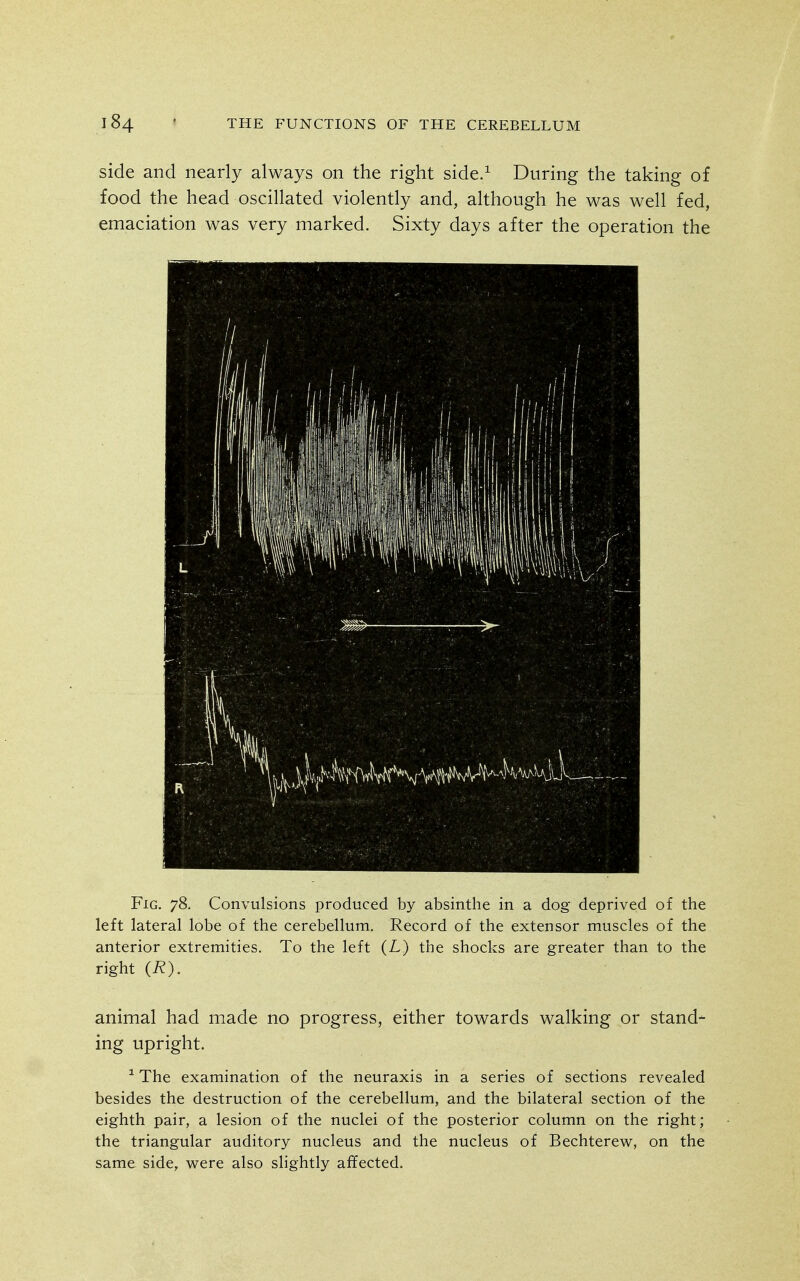 side and nearly always on the right side.^ During the taking of food the head oscillated violently and, although he was well fed, emaciation was very marked. Sixty days after the operation the Fig. 78. Convulsions produced by absinthe in a dog deprived of the left lateral lobe of the cerebellum. Record of the extensor muscles of the anterior extremities. To the left (L) the shocks are greater than to the right (R). animal had made no progress, either towards walking or stand- ing upright. ^ The examination of the neuraxis in a series of sections revealed besides the destruction of the cerebellum, and the bilateral section of the eighth pair, a lesion of the nuclei of the posterior column on the right; the triangular auditory nucleus and the nucleus of Bechterew, on the same side, were also shghtly affected.