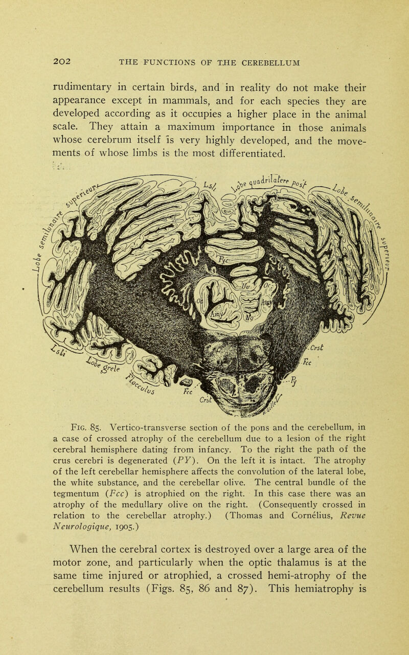 rudimentary in certain birds, and in reality do not make their appearance except in mammals, and for each species they are developed according as it occupies a higher place in the animal scale. They attain a maximum importance in those animals whose cerebrum itself is very highly developed, and the move- ments of whose limbs is the most differentiated. Fig. 85. Vertico-transverse section of the pons and the cerebellum, in a case of crossed atrophy of the cerebellum due to a lesion of the right cerebral hemisphere dating from infancy. To the right the path of the crus cerebri is degenerated (PY). On the left it is intact. The atrophy of the left cerebellar hemisphere affects the convolution of the lateral lobe, the white substance, and the cerebellar olive. The central bundle of the tegmentum (Fee) is atrophied on the right. In this case there was an atrophy of the medullary olive on the right. (Consequently crossed in relation to the cerebellar atrophy.) (Thomas and Cornehus, Revue Neurologique, 1905.) When the cerebral cortex is destroyed over a large area of the motor zone, and particularly when the optic thalamus is at the same time injured or atrophied, a crossed hemi-atrophy of the cerebellum results (Figs. 85, 86 and 87). This hemiatrophy is