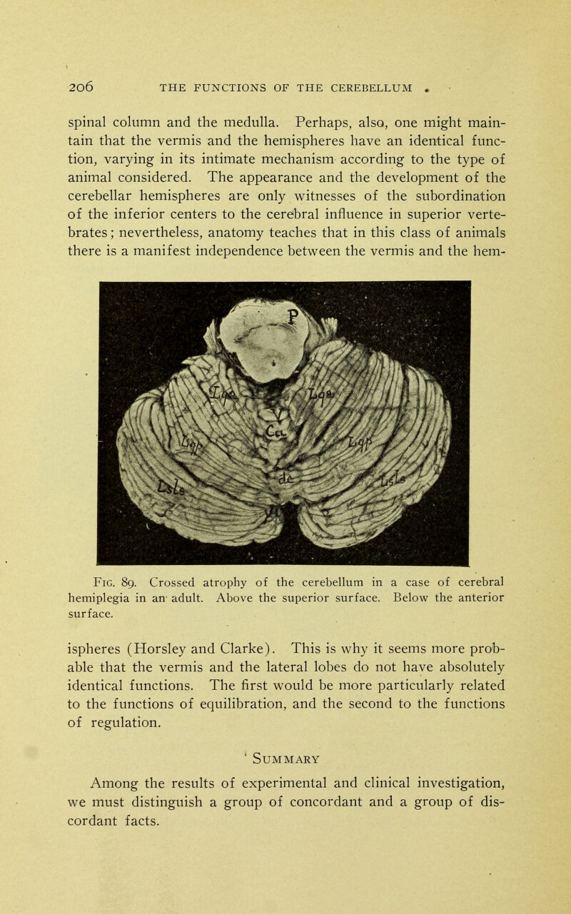 Spinal column and the medulla. Perhaps, also, one might main- tain that the vermis and the hemispheres have an identical func- tion, varying in its intimate mechanism according to the type of animal considered. The appearance and the development of the cerebellar hemispheres are only witnesses of the subordination of the inferior centers to the cereibral influence in superior verte- brates; nevertheless, anatomy teaches that in this class of animals there is a manifest independence between the vermis and the hem- FiG. 89. Crossed atrophy of the cerebellum in a case of cerebral hemiplegia in an' adult. Above the superior surface. Below the anterior surface. ispheres (Horsley and Clarke). This is why it seems more prob- able that the vermis and the lateral lobes do not have absolutely identical functions. The first would be more particularly related to the functions of equilibration, and the second to the functions of regulation. ' Summary Among the results of experimental and clinical investigation, we must distinguish a group of concordant and a group of dis- cordant facts.