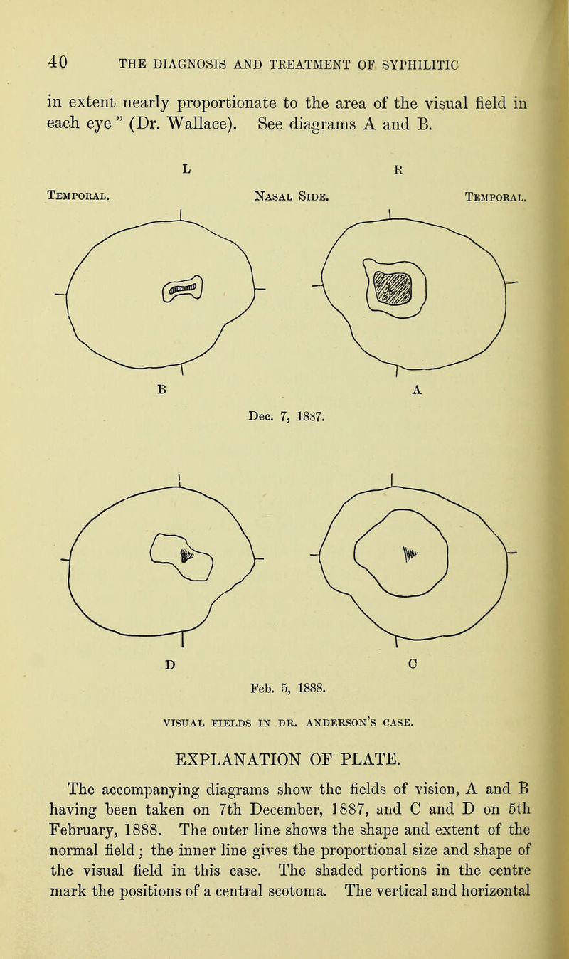 in extent nearly proportionate to the area of the visual field in each eye  (Dr. Wallace). See diagrams A and B. L R Temporal. Nasal Side. Temporal. D C Feb. 5, 1888. VISUAL FIELDS IN DR. ANDERSOn's CASE. EXPLANATION OF PLATE. The accompanying diagrams show the fields of vision, A and B having heen taken on 7th December, 1887, and C and D on 5th February, 1888. The outer line shows the shape and extent of the normal field; the inner line gives the proportional size and shape of the visual field in this case. The shaded portions in the centre mark the positions of a central scotoma. The vertical and horizontal