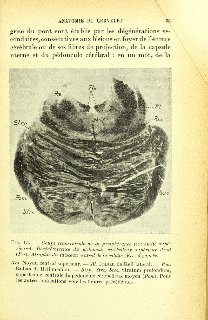 grise du pont sont etablis par les degenerations se- condaires^consecutives aux lesions en foyer de Feeoree cerebrale ou de ses fibres de projection, de la capsule nterne et du pedoncule cerebral : en un mot, de la Fig. 15. — Coupe trans vers ale de la protuberance (extremite supe- rieure). Degenerescence du pedoncule cerebelleux superieur droit (Pes). Atrophie du faisceau central de la calotte [Fee) a gauche. Ncs. Noyau central superieur. — Rl. Ruban de Reil lateral. — Mm. Ruban de Reil median. — Strp, Strs, Strc. Stratum profondum, superficiale, centrale du pedoncule cerebelleux moyen (Pcm). Pour les autres indications voir les figures precedentes.