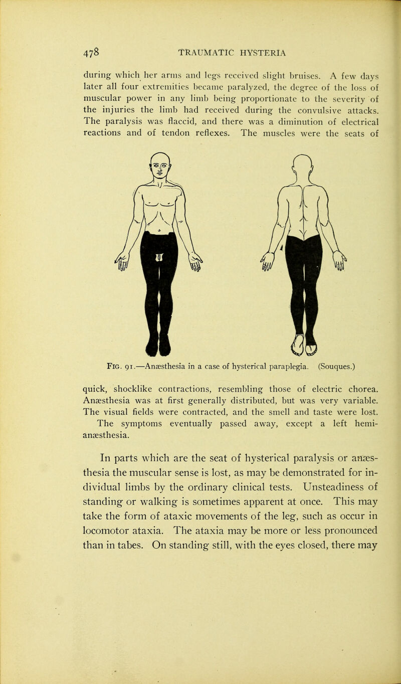 during which her arms and legs received slight bruises. A few days later all four extremities became paralyzed, the degree of the loss of muscular power in any limb being proportionate to the severity of the injuries the limb had received during the convulsive attacks. The paralysis was flaccid, and there was a diminution of electrical reactions and of tendon reflexes. The muscles were the seats of Fig. 91.—An£Esthesia in a case of hysterical paraplegia. (Souques.) quick, shocklike contractions, resembling those of electric chorea. Anaesthesia was at first generally distributed, but was very variable. The visual fields were contracted, and the smell and taste were lost. The symptoms eventually passed away, except a left hemi- ansesthesia. In parts which are the seat of hysterical paralysis or anaes- thesia the muscular sense is lost, as may be demonstrated for in- dividual limbs by the ordinary clinical tests. Unsteadiness of standing or walking is sometimes apparent at once. This may take the form of ataxic movements of the leg, such as occur in locomotor ataxia. The ataxia may be more or less pronounced than in tabes. On standing still, with the eyes closed, there may