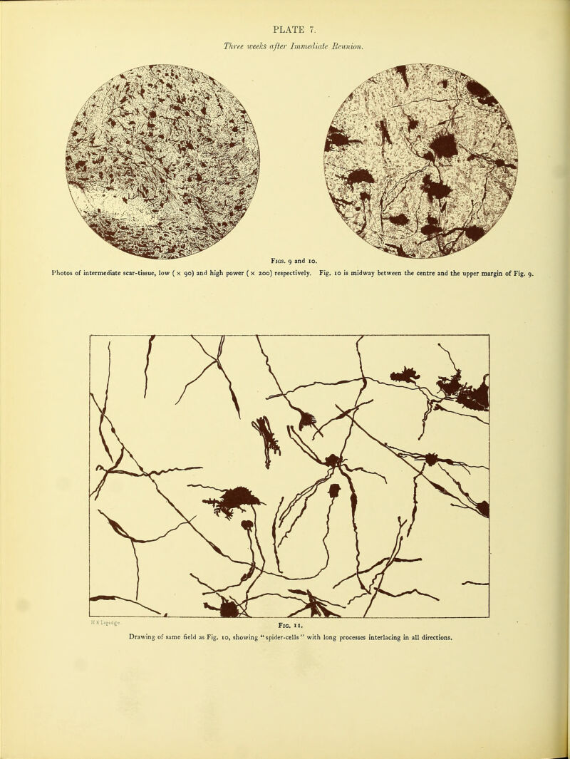 PLATE 7. Three weeks after Immediate Reunion. Drawing of same field as Fig. lo, showing spider-cells with long processes interlacing in all directions.