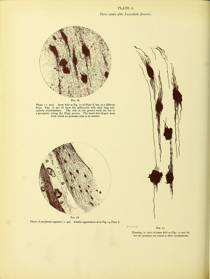 Three weeks after Immediate Reunion. Fig. 16. Photo ( X 200). Same field as Fig. 15 of Plate 8, but at a different focus. Figs. 15 and 16 show the spider-cells with their long axis- cylinder continuations. The dots in the ground-work are due to a precipitate during the Golgi process. The dumb-bell-shaped mass from which no processes arise is an artefact. Fig. 18. Photo of peripheral segment (x 90). Similar appearances as in Fig. 14, Plate M.K.Lapidge. Fig. ly. Drawing ( x 200) of same field as Figs. 15 and 16, but the processes are traced to their terminations.