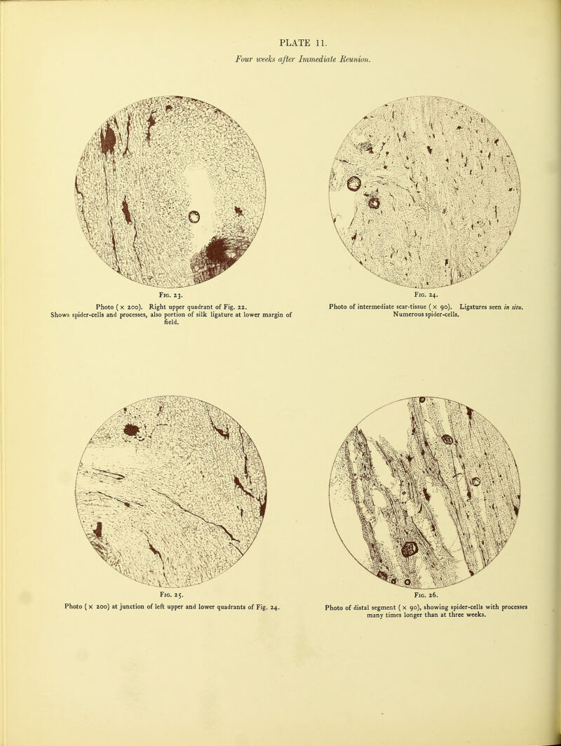 PLATE 11. Four weeks after Immediaie Reunion.