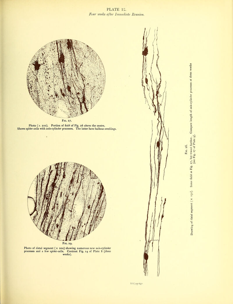 PLATE 12. Four weeks after Immediate Reunion. MHLapidge