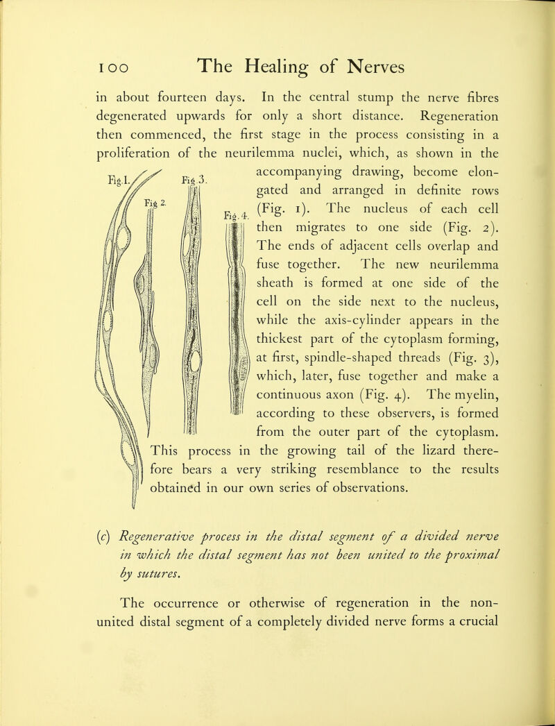 Fi6 3. in about fourteen days. In the central stump the nerve fibres degenerated upwards for only a short distance. Regeneration then commenced, the first stage in the process consisting in a proliferation of the neurilemma nuclei, which, as shown in the accompanying drawing, become elon- gated and arranged in definite rows (Fig. i). The nucleus of each cell then migrates to one side (Fig. 2). The ends of adjacent cells overlap and fuse together. The new neurilemma sheath is formed at one side of the cell on the side next to the nucleus, while the axis-cylinder appears in the thickest part of the cytoplasm forming, at first, spindle-shaped threads (Fig. 3), which, later, fuse together and make a continuous axon (Fig. 4). The myelin, according to these observers, is formed from the outer part of the cytoplasm. This process in the growing tail of the lizard there- fore bears a very striking resemblance to the results obtained in our own series of observations. (c) Regenerative process in the distal segment of a divided 7^erve in which the distal segment has not been united to the proximal by sutures. The occurrence or otherwise of regeneration in the non- united distal segment of a completely divided nerve forms a crucial