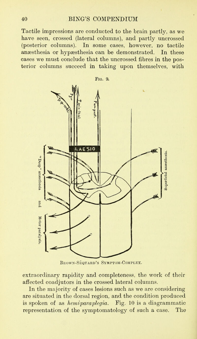 Tactile impressions are conducted to the brain partly, as we have seen, crossed (lateral columns), and partly uncrossed (posterior columns). In some cases, however, no tactile anaesthesia or hypsesthesia can be demonstrated. In these cases we must conclude that the uncrossed fibres in the pos- terior columns succeed in taking upon themselves, with Fig. 9. Beown-Sequard's Symptom-Complex. extraordinary rapidity and completeness, the work of their affected coadjutors in the crossed lateral columns. In the majority of cases lesions such as we are considering are situated in the dorsal region, and the condition produced is spoken of as hemiparaplegia. Fig. 10 is a diagrammatic representation of the symptomatology of such a case. The