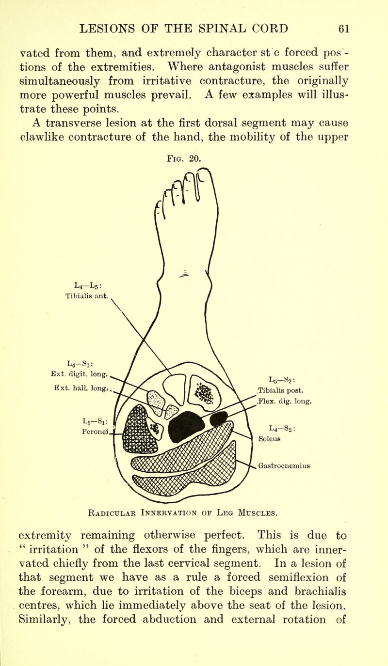 vated from them, and extremely character st c forced pos - tions of the extremities. Where antagonist muscles suffer simultaneously from irritative contracture, the originally more powerful muscles prevail. A few examples will illus- trate these points. A transverse lesion at the first dorsal segment may cause clawlike contracture of the hand, the mobility of the upper Fig. 20. Radicular Innervation of Leg Muscles. extremity remaining otherwise perfect. This is due to  irritation  of the flexors of the fingers, which are inner- vated chiefly from the last cervical segment. In a lesion of that segment we have as a rule a forced semiflexion of the forearm, due to irritation of the biceps and brachialis centres, which lie immediately above the seat of the lesion. Similarly, the forced abduction and external rotation of