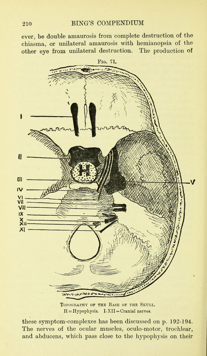 ever, be double amaurosis from complete destruction of the chiasma, or unilateral amaurosis with hemianopsia of the other eye from unilateral destruction. The production of Fig. 71. Topography of the Base of the Skull. H = Hypophysis. I-XII = Cranial nerves. these symptom-complexes has been discussed on p. 192-194. The nerves of the ocular muscles, oculo-motor, trochlear, and abducens, which pass close to the hypophysis on their