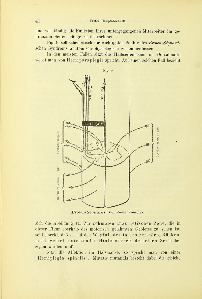 und vollstandig die Funktion ihrer untergegangenen Mitarbeiter im ge- kreuzten Seitenstrange zu iibernehmen, Fig. 9 soil schematisch die wichtigsten Punkte des Broum-Sequard- schen Syndroms anatomisch-physiologisch zusammenfassen. In den meisten Fallen sitzt die Halbseitenlasion im Dorsalmark, wobei man von Hemiparaplegie spricht. Auf einen solchen Fall bezieht Fig. 9. Brown-Sequards Symptomenkomplex. sich die Abbildung 10. Zur schmalen anasthetischen Zone, die in dieser Figur oberhalb des motorisch gelahmten Gebietes zu sehen ist, sei bemerkt, daC sie auf den Wegfall der in das zerstorte Riicken- marksgebiet eintretenden Hinterwurzeln derselben Seite be- zogen werden mufi. Sitzt die Affektion im Halsmarke, so spricht man von einer ,.Hemiplegia spinalis. Mutatis mutandis besteht dabei die gleiche