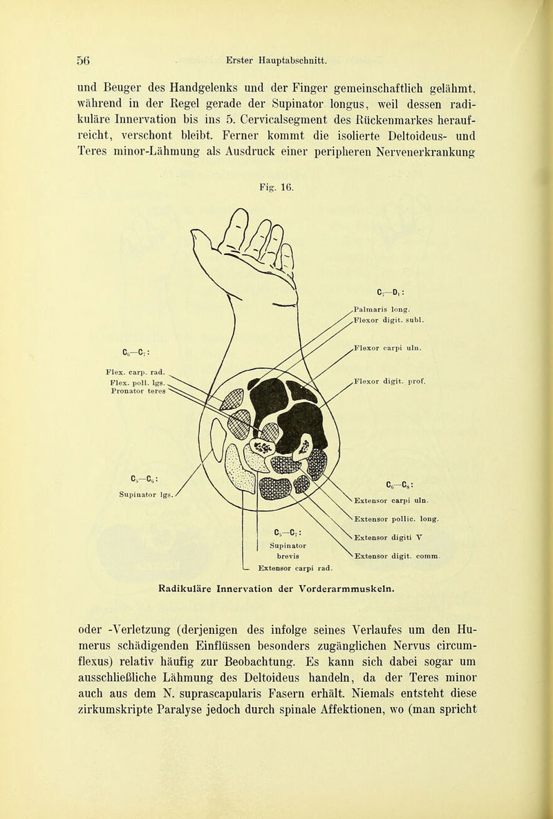 und Beuger des Handgelenks und der Finger gemeinschaftlich gelahmt, wahrend in der Regel gerade der Supinator longus, weil dessen radi- kulare Innervation bis ins 5. Cervicalsegment des Riickenmarkes herauf- reicht, verschont bleibt. Ferner kommt die isolierte Deltoideus- und Teres minor-Lahmung als Ausdruck einer peripheren Nervenerkrankung Fig. 16. Flex. carp. rad. Flex. poll. Igs. Pronator teres Palmaris long. Flexor digit, subl. Flexor carpi uln Flexor digit, prof. C0-C8: Extensor carpi uln. Extensor pollic. long. Extensor digiti V Extensor digit, comm. Radikulare Innervation der Vorderarmmuskeln. oder -Verletzung (derjenigen des infolge seines Verlaufes um den Hu- merus schadigenden Einflussen besonders zuganglichen Nervus circum- flexus) relativ haufig zur Beobachtung. Es kann sich dabei sogar um ausschlieflliche Lahmung des Deltoideus handeln, da der Teres minor auch aus dem N. suprascapularis Fasern erhalt. Niemals entsteht diese zirkumskripte Paralyse jedoch durch spinale Affektionen, wo (man spricht