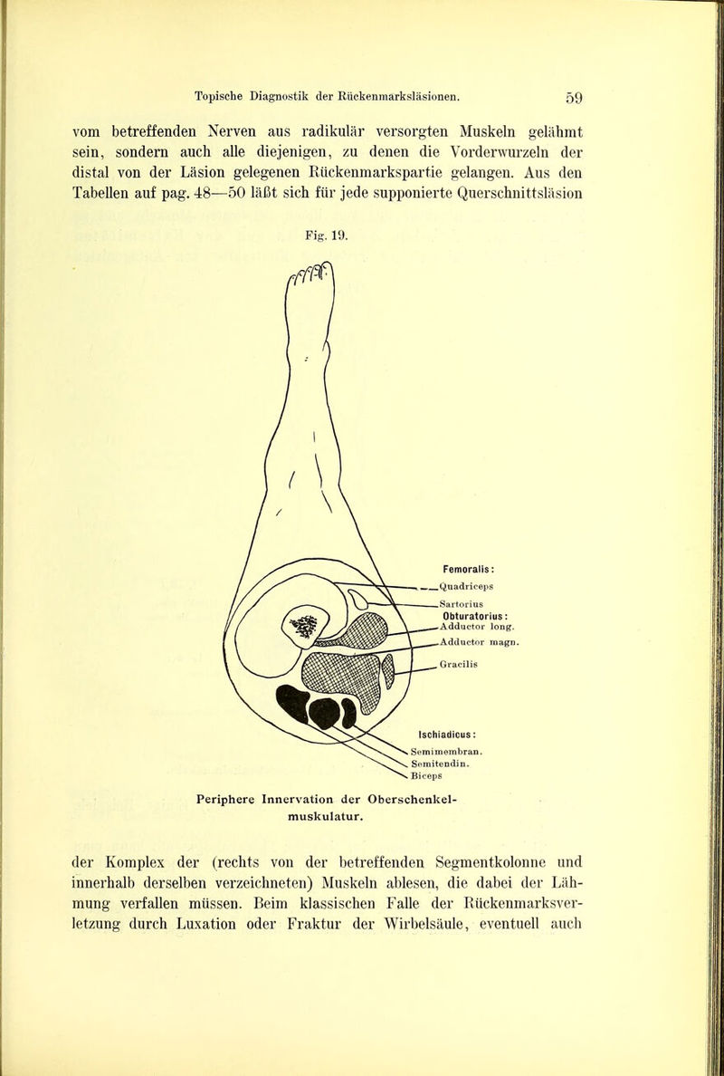vom betreffenden Nerven aus radikular versorgten Muskeln gelahmt sein, sondern auch alle diejenigen, zu denen die Vorderwurzeln der distal von der Lasion gelegenen Riickenmarkspartie gelangen. Aus den Tabellen auf pag. 48—50 lafit sich fur jede supponierte Querschnittslasion Fig. 19. Periphere Innervation der Oberschenkel- muskulatur. der Komplex der (rechts von der betreffenden Segmentkolonne und innerhalb derselben verzeichneten) Muskeln ablesen, die dabei der Lah- mung verfallen miissen. Beim klassischen Falle der Riickenmarksver- letzung durch Luxation oder Fraktur der Wirbelsaule, eventuell auch
