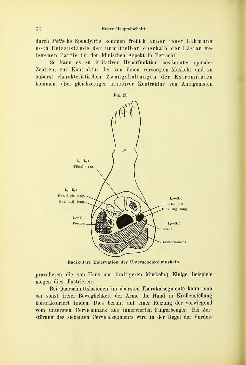 durch Porsche Spondylitis kommen freilich aufier jener Lahmung aoch Reizzustande der unmittelbar oberhalb der Lasion ge- legenen Partie fiir den klinischen Aspekt in Betracht. So kann es zu irritativer Hyperfunktion bestimmter spinaler Zentren, zur Kontraktur der von ihnen versorgten Muskeln und zu aufierst charakteristischen Zwangshaltungen der Extremitaten kommen. (Bei gleichzeitiger irritativer Kontraktur von Antagonisten Fig. 20. Radikulare Innervation der Unterschenkelmuskeln. pravalieren die von Haus aus kraftigeren Muskeln.) Einige Beispiele mogen dies illustrieren: Bei Querschnittslasionen im obersten Thorakalsegmente kann man bei sonst freier Beweglichkeit der Arme die Hand in Krallenstellung kontrakturiert finden. Dies beruht auf einer Reizung der vorwiegend vom untersten Cervicalmark aus innervierten Fingerbeuger. Bei Zer- storung des siebenten Cervicalsegments wird in der Regel der Vorder-