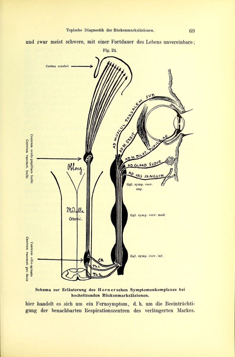 Schema zur Erlauterung des Hornerschen Symptomenkomplexes bei hochsitzenden Riickenmarkslasionen. hier handelt es sich um ein Fernsymptom, d. h. um die Beeintrachti- gung der henachbarten Respirationszentren des verlangerten Markes.