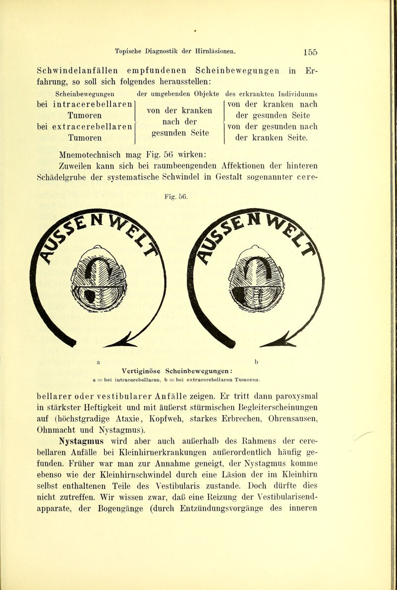 Schwindelanf alien empfundenen Scheinbewegungen in Er- fahrung, so soil sich folgendes herausstellen: Scheinbewegungen der umgebenden Objekte bei intracerebellaren Tumoren bei extracerebellaren Tumoren von der kranken nach der gesunden Seite des erkrankten Individuums von der kranken nacb der gesunden Seite von der gesunden nacb der kranken Seite. Mnemotecbnisch mag Fig. 56 wirken: Zuweilen kann sicb bei raumbeengenden Affektionen der hinteren Schadelgrube der systematische Schwindel in Gestalt sogenannter cere- Fig. 56. Vertiginose Scheinbewegungen: a — bei intracerebellaren. b = bei extracerebellaren Tumoren. bellarer oder vestibularer Anfalle zeigen. Er tritt dann paroxysmal in starkster Heftigkeit und mit aufierst stiirmischen Begleiterscheinungen auf (hochstgradige Ataxie, Kopfweh, starkes Erbrechen, Ohrensausen, Ohnmacht und Nystagmus). Nystagmus wird aber auch aufierhalb des Rabmens der cere- bellaren Anfalle bei Kleinhirnerkrankungen auCerordentlich biiufig ge- funden. Friiher war man zur Annabme geneigt, der Nystagmus komme ebenso wie der Kleinhirnschwindel durch eine Lasion der im Kleinbirn selbst enthaltenen Teile des Vestibularis zustande. Doch diirfte dies nicht zutreffen. Wir wissen zwar, daB eine Reizung der Vestibularisend- apparate, der Bogengilnge (durch Entziindungsvorgange des inneren