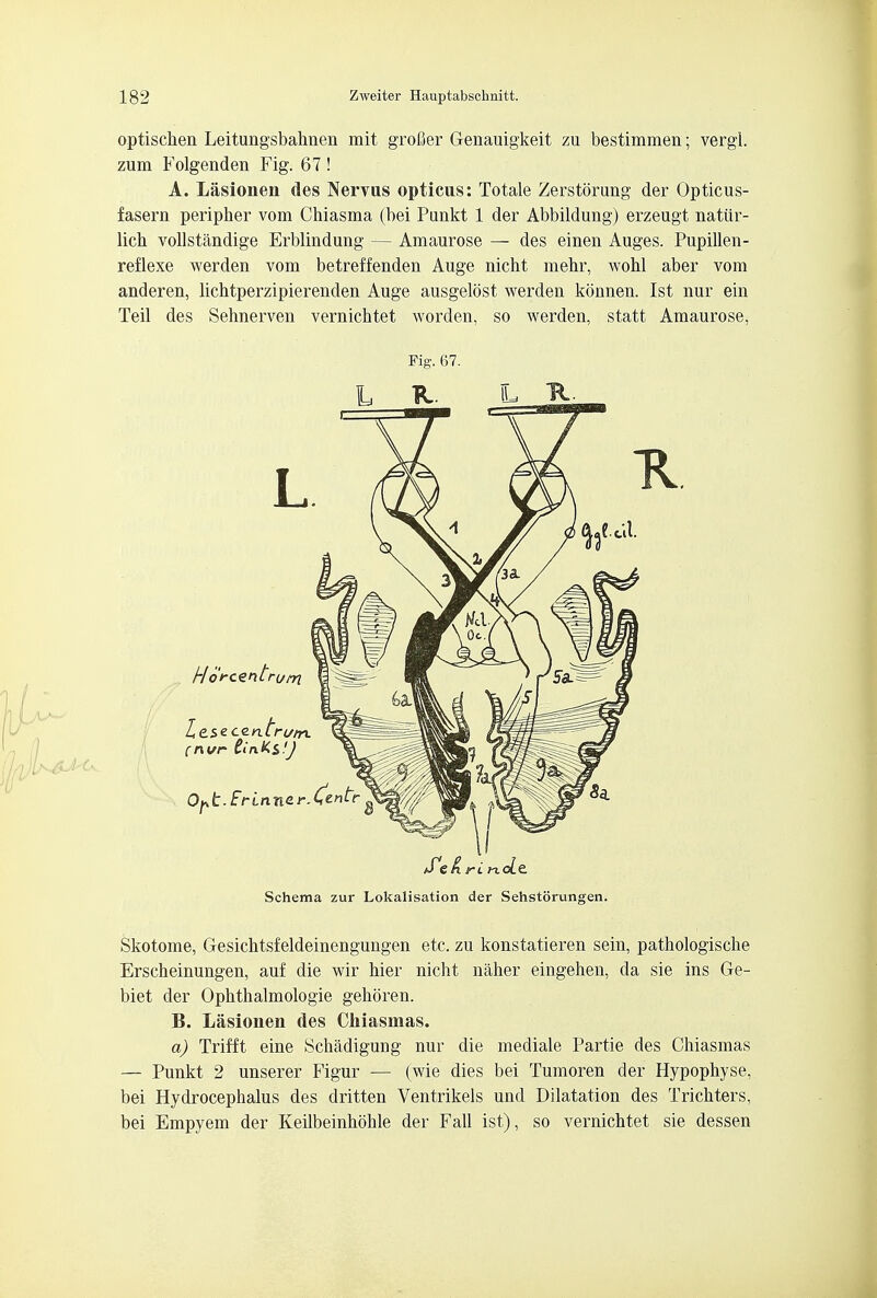 optischen Leitungsbahnen mit grofier G-enauigkeit zu bestimmen; vergl. zum Folgenden Fig. 67 ! A. Lasionen des Nervus opticus: Totale Zerstorung der Opticus- fasern peripher vom Chiasma (bei Punkt 1 der Abbildung) erzeugt natiir- lich vollstandige Erblindung — Amaurose — des einen Auges. Pupillen- reflexe werden vom betreffenden Auge nicht mehr, Avohl aber vom anderen, lichtperzipierenden Auge ausgelost werdeu konnen. 1st nur em Teil des Sehnerven veruichtet worden, so werden, statt Amaurose, Pig. 67. S1sKrinde. Schema zur Lokalisation der Sehstorungen. Skotome, Gesichtsfeldeinengungen etc. zu konstatieren sein, pathologische Erscheinungen, auf die wir hier nicht naher eingehen, da sie ins Ge- biet der Ophthalmologic gehoren. B. Lasionen des Chiasmas. a) Trifft eine Schadigung nur die mediale Partie des Chiasmas — Punkt 2 unserer Figur — (wie dies bei Tumoren der Hypophyse, bei Hydrocephalus des dritten Ventrikels und Dilatation des Trichters, bei Empyem der Keilbeinhohle der Fall ist), so vernichtet sie dessen