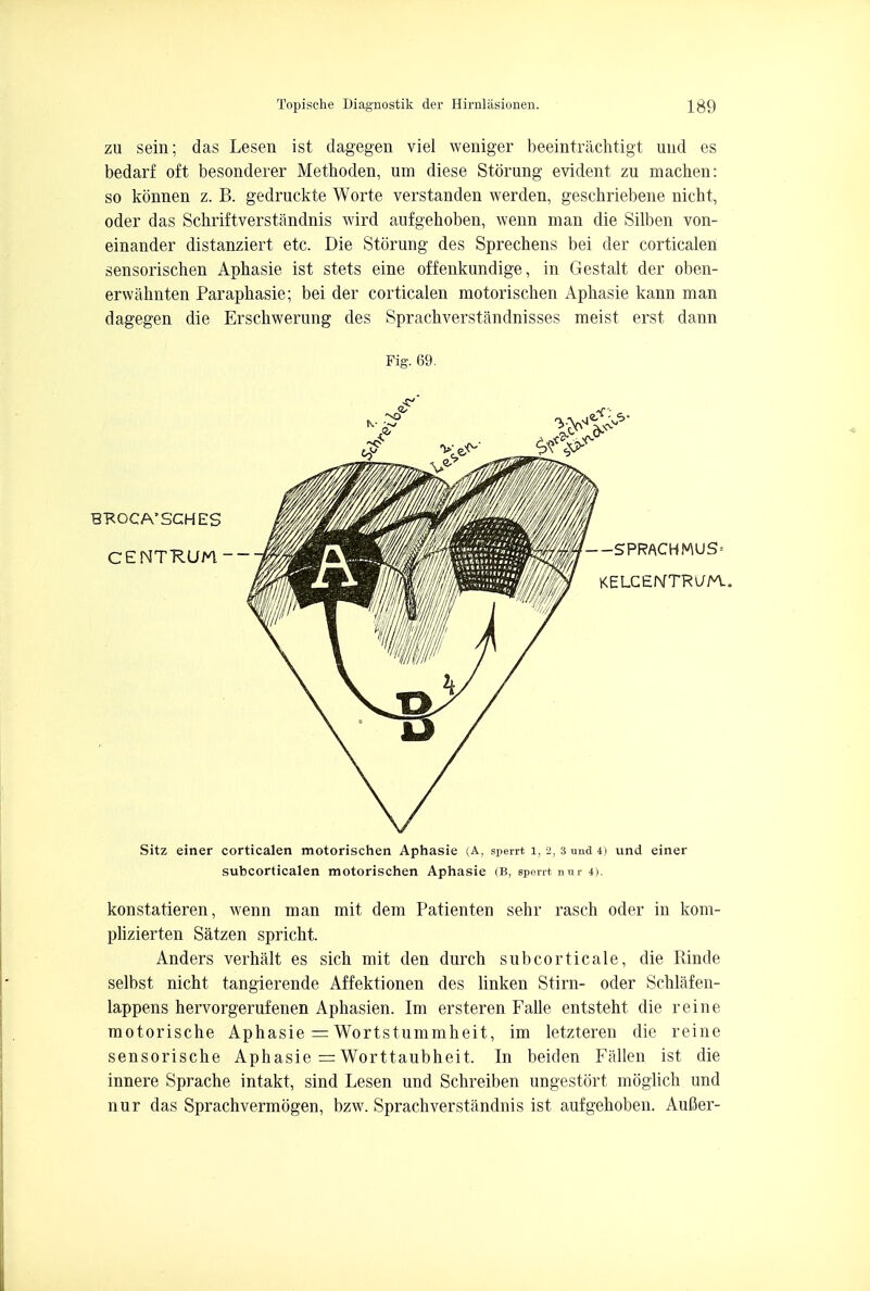 zu sein; das Lesen ist dagegen viel weniger beeintrachtigt und es bedarf oft besonderer Methoden, um diese Storung evident zu machen: so konnen z. B. gedruckte Worte verstanden werden, geschriebene nicht, oder das Schriftverstandnis wird aufgehoben, wenn man die Silben von- einander distanziert etc. Die Storung des Sprechens bei der corticalen sensorischen Aphasie ist stets eine offenkundige, in Gestalt der oben- erwatmten Paraphasie; bei der corticalen motorischen Apbasie kann man dagegen die Erschwerung des Sprachverstandnisses meist erst dann Fig. 69. BKOCA'S'CHES CENTRUM_ Sitz einer corticalen motorischen Aphasie (A, sperrt 1, 2, 3 una 4) und einer subcorticalen motorischen Aphasie (B, spent, nur 4>. konstatieren, wenn man mit dem Patienten sehr rasch oder in kom- plizierten Satzen spricht. Anders verhalt es sicb mit den durch subcorticale, die Rinde selbst nicht tangierende Affektionen des linken Stirn- oder Schlafen- lappens hervorgerufenen Aphasien. Im ersteren Falle entsteht die reine motorische Aphasie = Wortstummheit, im letzteren die reine sensorische Aphasie = Worttaubheit. In beiden Fallen ist die innere Sprache intakt, sind Lesen und Schreiben ungestort moglich und nur das Sprachvermogen, bzw. Sprachverstandnis ist aufgehoben. AuBer-