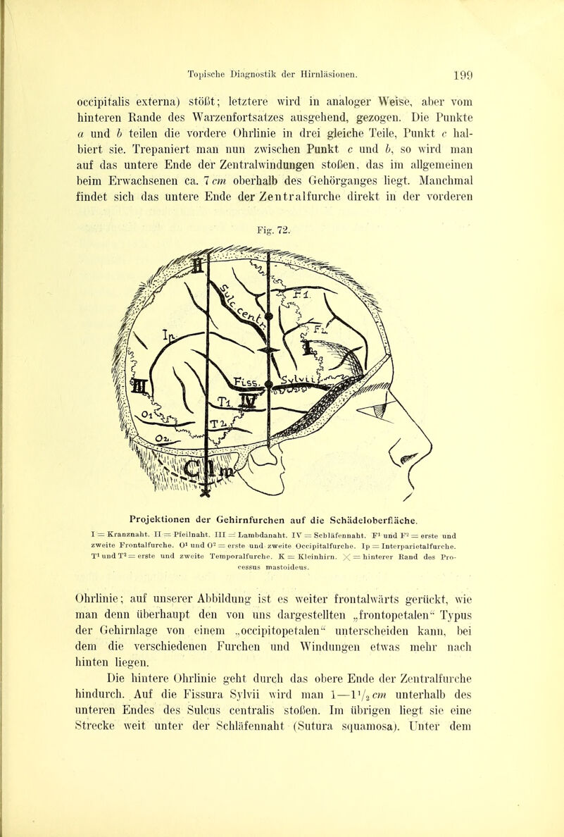 occipitalis externa) stoflt; letztere wird in analoger Weise, aber vom hinteren Rande des Warzenfortsatzes ausgehend, gezogen. Die Punkte a und b teilen die vordere Ohrlinie in drei gleiche Teile, Punkt c hal- biert sie. Trepaniert man nun zwischen Punkt c und b, so wird man auf das untere Ende der Zentralwindungen stoBen, das ihi allgemeinen beim Erwachsenen ca. 7 cm oberhalb des Gehorganges liegt. Manchmal findet sich das untere Ende der Zentralfurche direkt in der vorderen Fig. 72, Projektionen der Gehirnfurchen auf die Schadeloberfiache. I = Kranznaht. II = Pfeilnaht. Ill = Lambdanaht. IV = Scblafennaht. F1 und F2 = erste und zweite Frontalfurche. O1 und O2 = erste und zweite Occipitalfurcbe. Ijj = Interparietalfurche. T1 und Ts = erste und zweite Temporalfurche. K = Kleinbirn. = hinterer Eand des Pro- cessus mastoideus. Ohrlinie; auf unserer Abbildung ist es weiter frontalwiirts geruckt, wie man denn iiberhaupt den von uns dargestellten „frontopetalen'L Typus der Gehirnlage von einem .,occipitopetalenu unterscheiden kann, bei dem die verschiedenen Furchen und Windungen etwas mehr nach hinten liegen. Die hintere Ohrlinie geht durch das obere Ende der Zentralfurche hindurch. Auf die Fissura Sylvii wird man 1—V/2cm unterhalb des unteren Endes des Sulcus centralis stolen. Im iibrigen liegt sie eine Strecke weit unter der Schliifennaht (Sutura squamosa). Unter dem