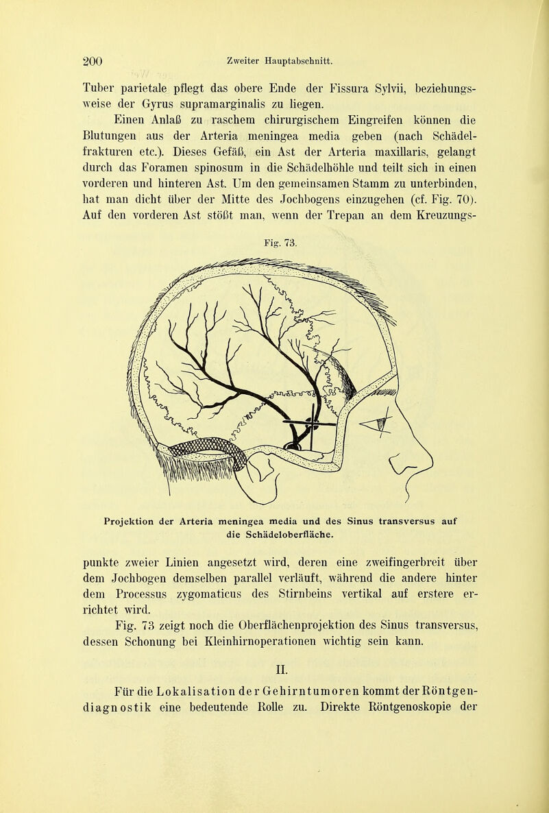 Tuber parietale pflegt das obere Ende der Fissura Sylvii, beziehungs- weise der Gyrus supramarginalis zu liegen. Einen Anlafi zu raschem chirurgischem Eingreifen konnen die Blutungen aus der Arteria meningea media geben (nach Schadel- frakturen etc.). Dieses Gefafi, ein Ast der Arteria maxillaris, gelangt durch das Foramen spinosum in die Schadelhohle und teilt sich in einen vorderen und hinteren Ast. Um den gemeinsamen Stamm zu unterbinden, hat man dicht iiber der Mitte des Jochbogens einzugehen (cf. Fig. 70). Auf den vorderen Ast stoflt man, wenn der Trepan an dem Kreuzungs- Fig. 73. Projektion der Arteria meningea media und des Sinus transversus auf die Schadeloberfiache. punkte zweier Linien angesetzt wird, deren eine zweifingerbreit iiber dem Jochbogen demselben parallel verlauft, wahrend die andere hinter dem Processus zygomaticus des Stirnbeins vertikal auf erstere er- richtet wird. Fig. 73 zeigt noch die Oberflachenprojektion des Sinus transversus, dessen Schonung bei Kleinhirnoperationen wichtig sein kann. II. Fiir die Lokalisation der Gehirntumoren kommt derRbntgen- diagnostik eine bedeutende Rolle zu. Direkte Rontgenoskopie der